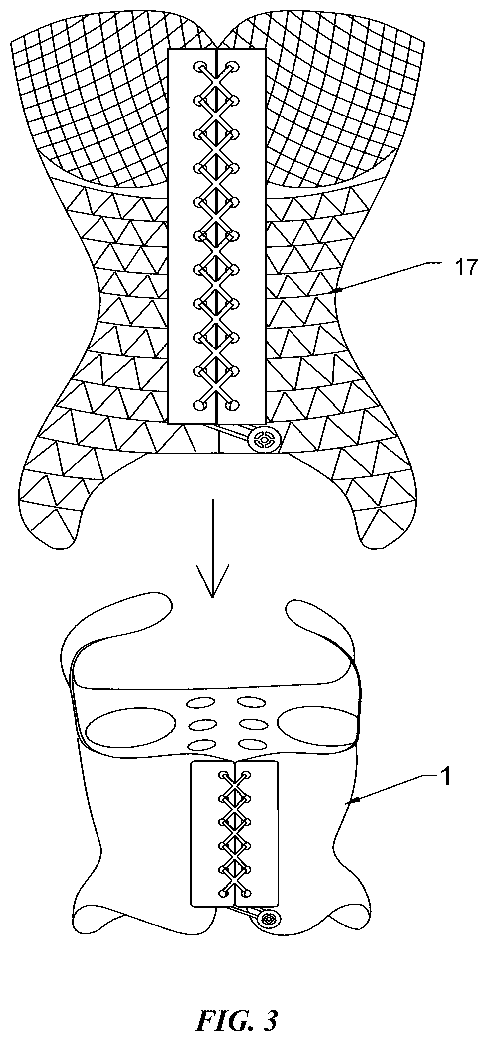 Patent US12303420 Figure 3 – Adjustable scoliosis orthosis and use method thereof