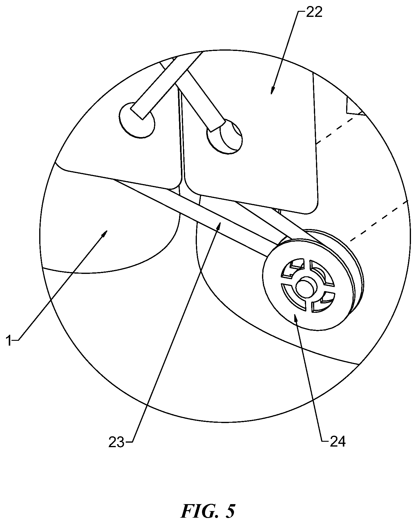 Patent US12303420 Figure 5 – Adjustable scoliosis orthosis and use method thereof