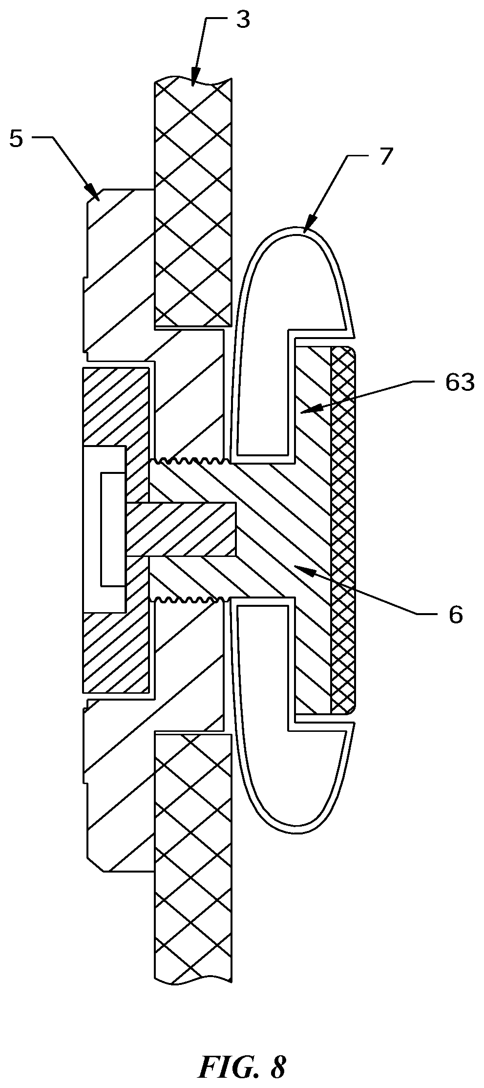 Patent US12303420 Figure 8 – Adjustable scoliosis orthosis and use method thereof