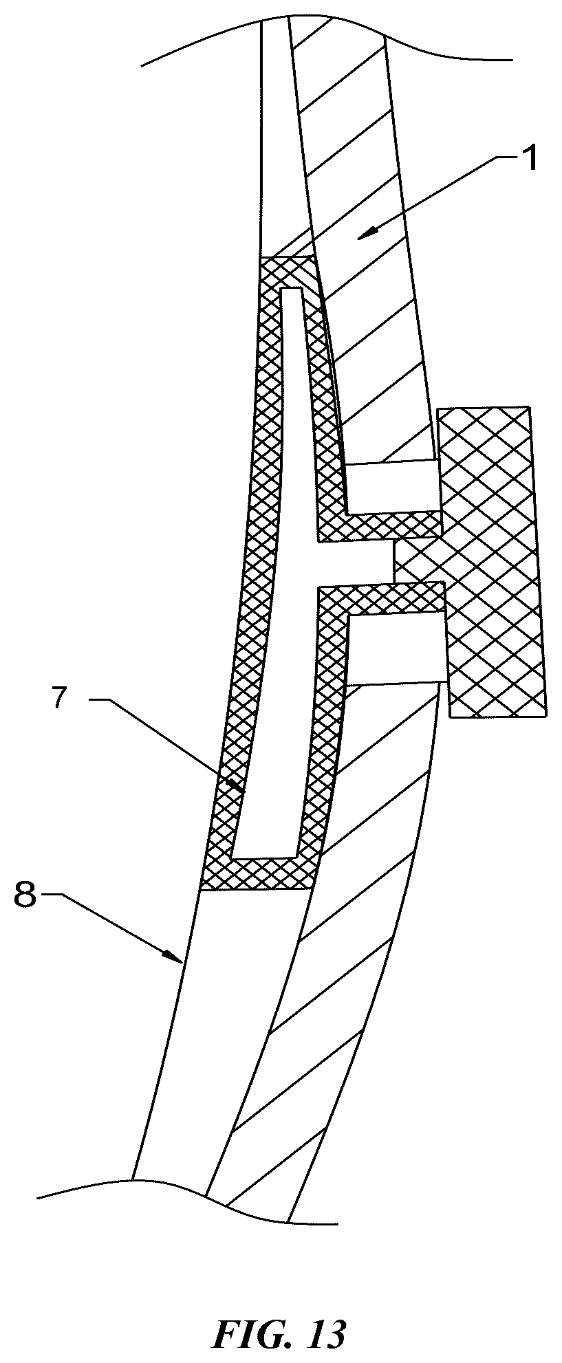 Patent US12303420 Figure 13 – Adjustable scoliosis orthosis and use method thereof