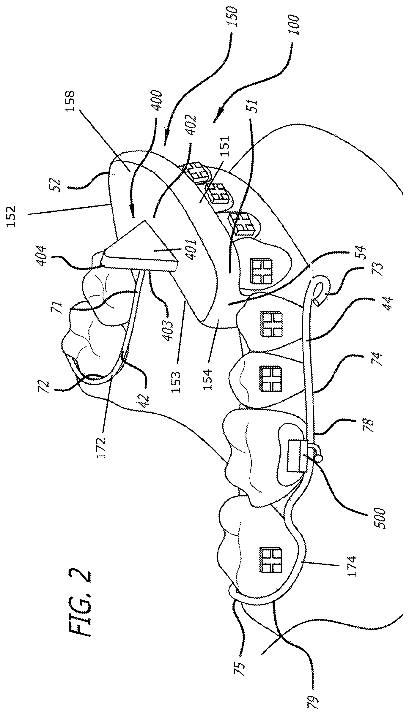 Patent US12303424 Figure 2 – Adjustable sleep apnea oral appliance for use with orthodontic braces