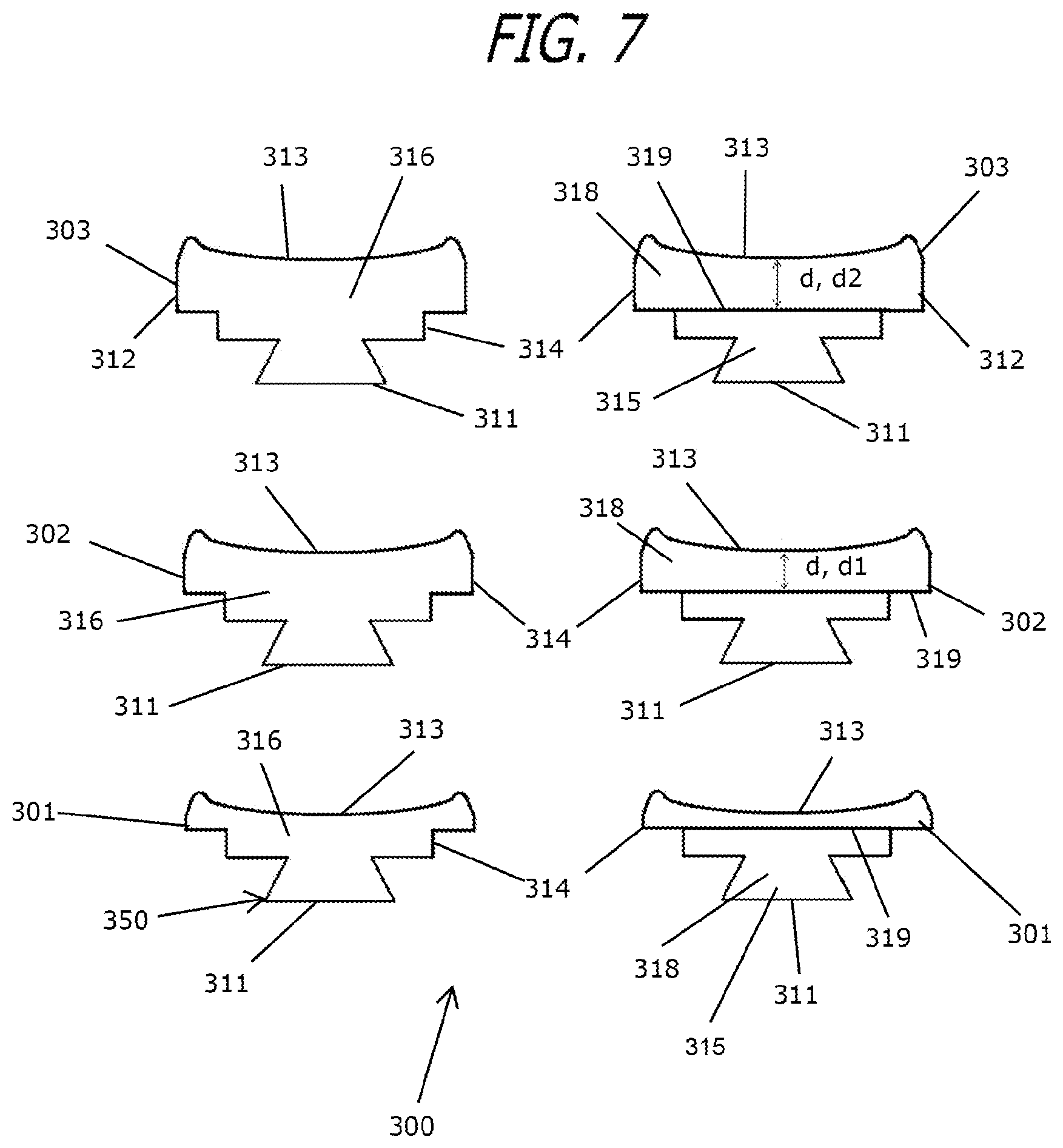 Patent US12303424 Figure 7 – Adjustable sleep apnea oral appliance for use with orthodontic braces