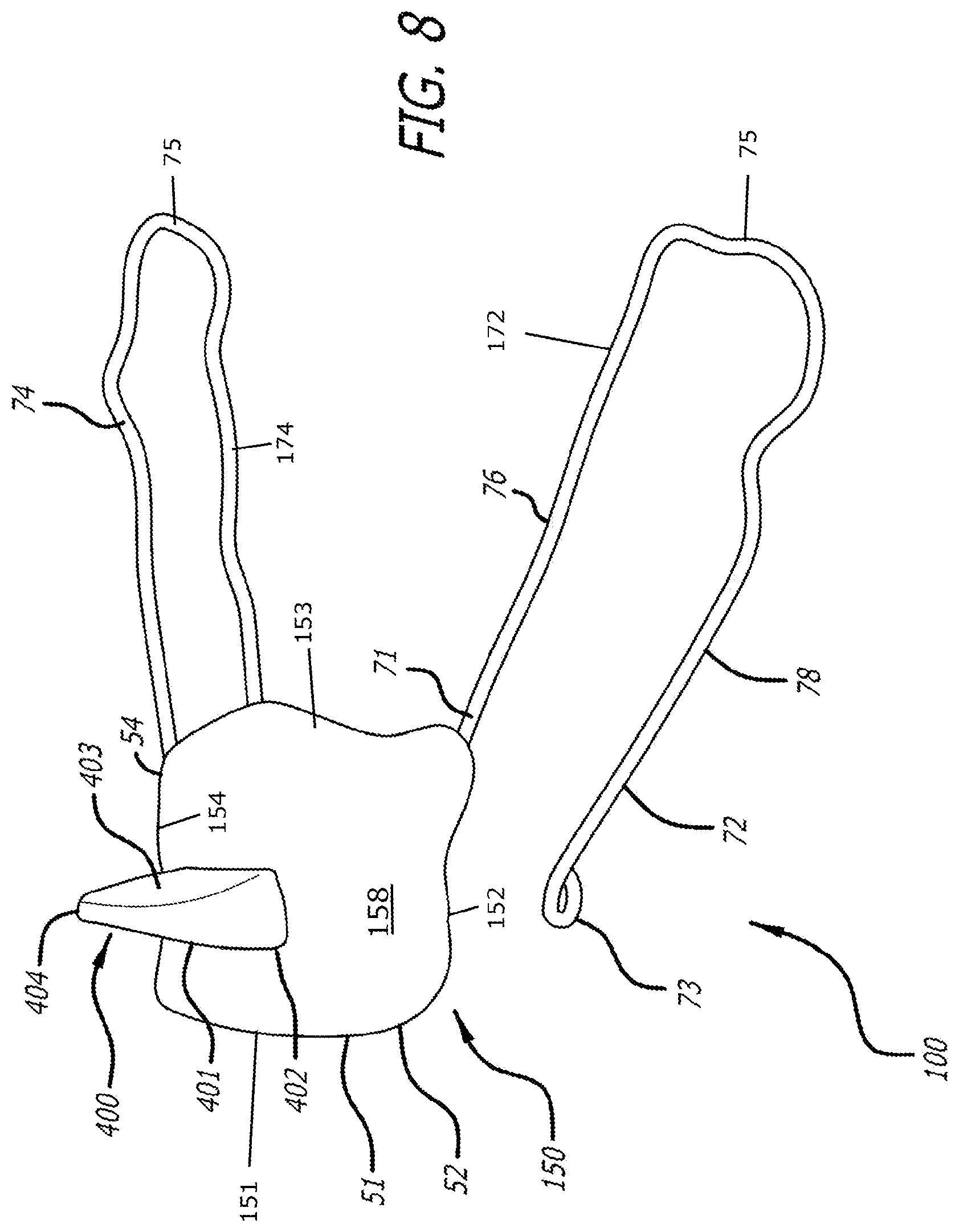 Patent US12303424 Figure 8 – Adjustable sleep apnea oral appliance for use with orthodontic braces