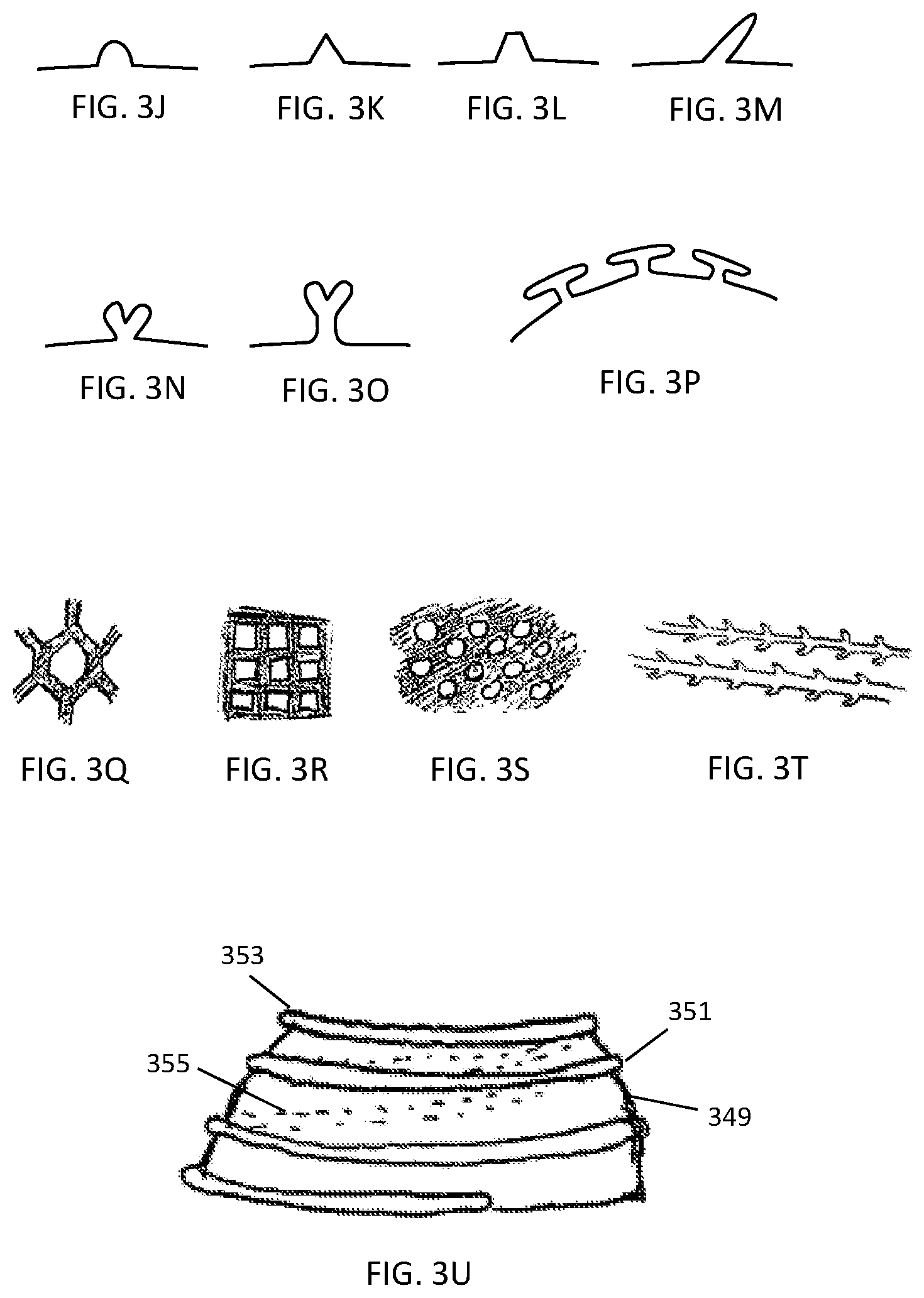 Patent US12303425 Figure 3 – Methods and devices to prevent premature birth, stillbirth, miscarriage, infection, or pregnancy