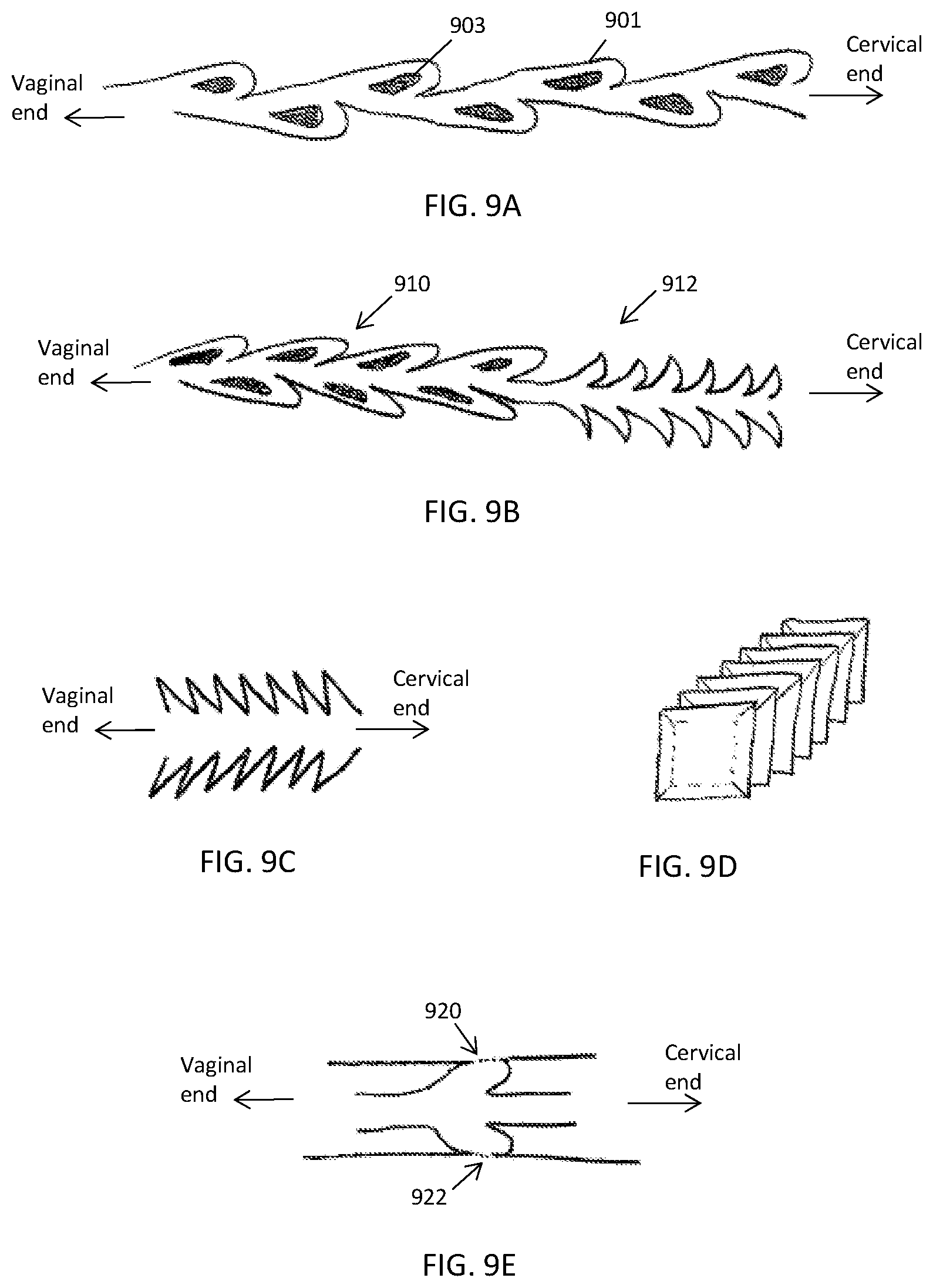 Patent US12303425 Figure 9 – Methods and devices to prevent premature birth, stillbirth, miscarriage, infection, or pregnancy