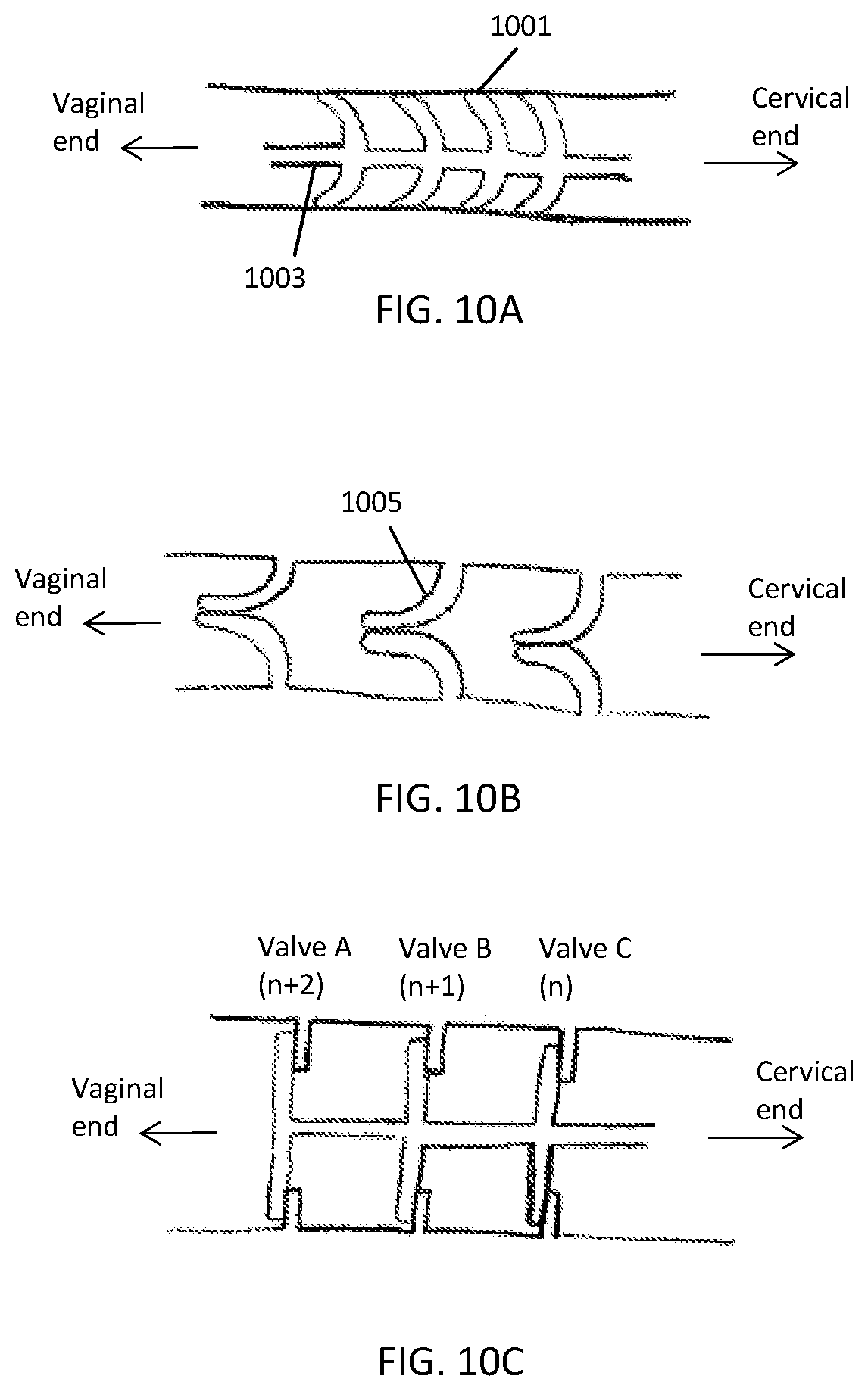 Patent US12303425 Figure 10 – Methods and devices to prevent premature birth, stillbirth, miscarriage, infection, or pregnancy