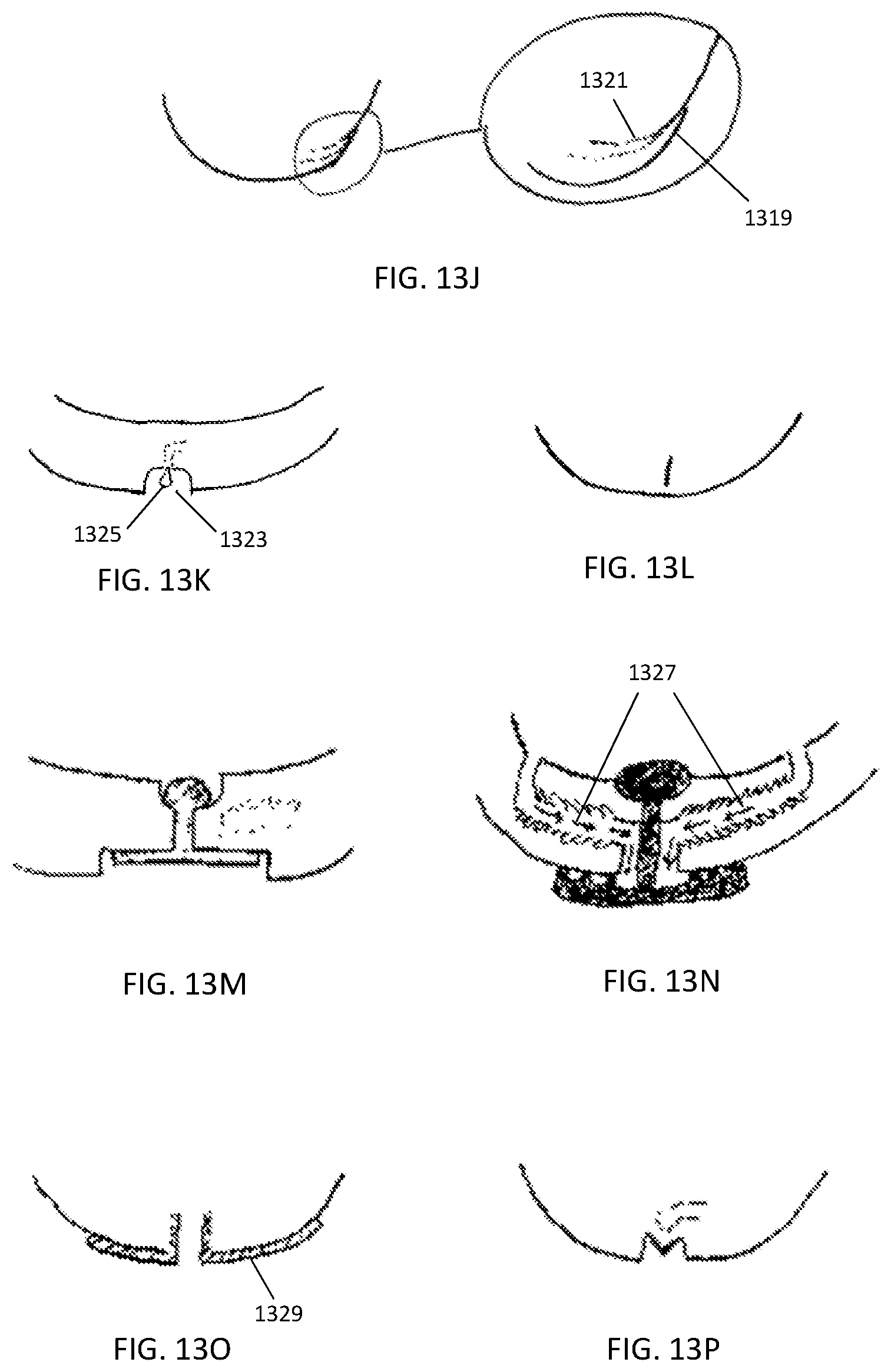 Patent US12303425 Figure 14 – Methods and devices to prevent premature birth, stillbirth, miscarriage, infection, or pregnancy