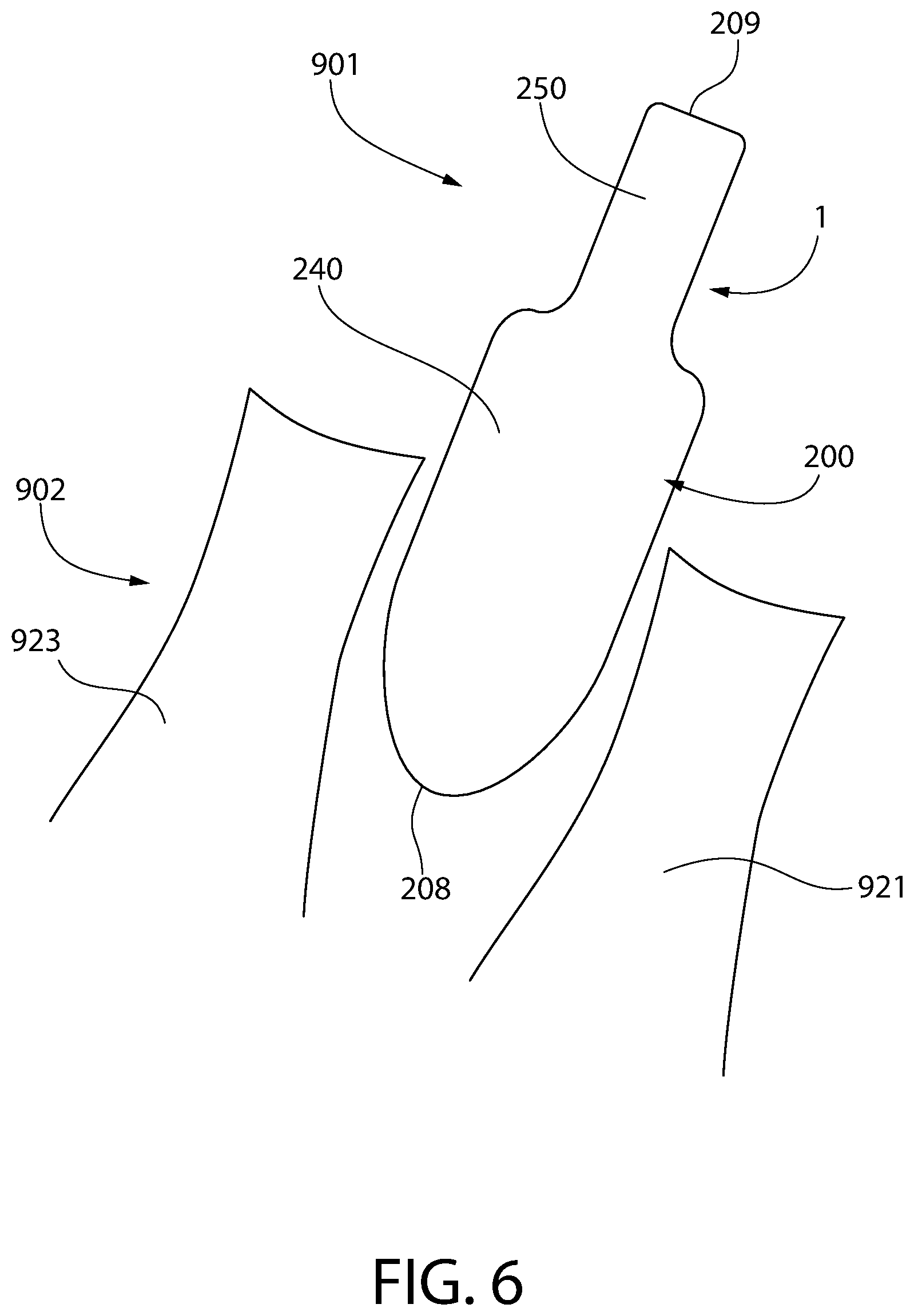 Patent US12303429 Figure 6 – Method and device for treating eye disease