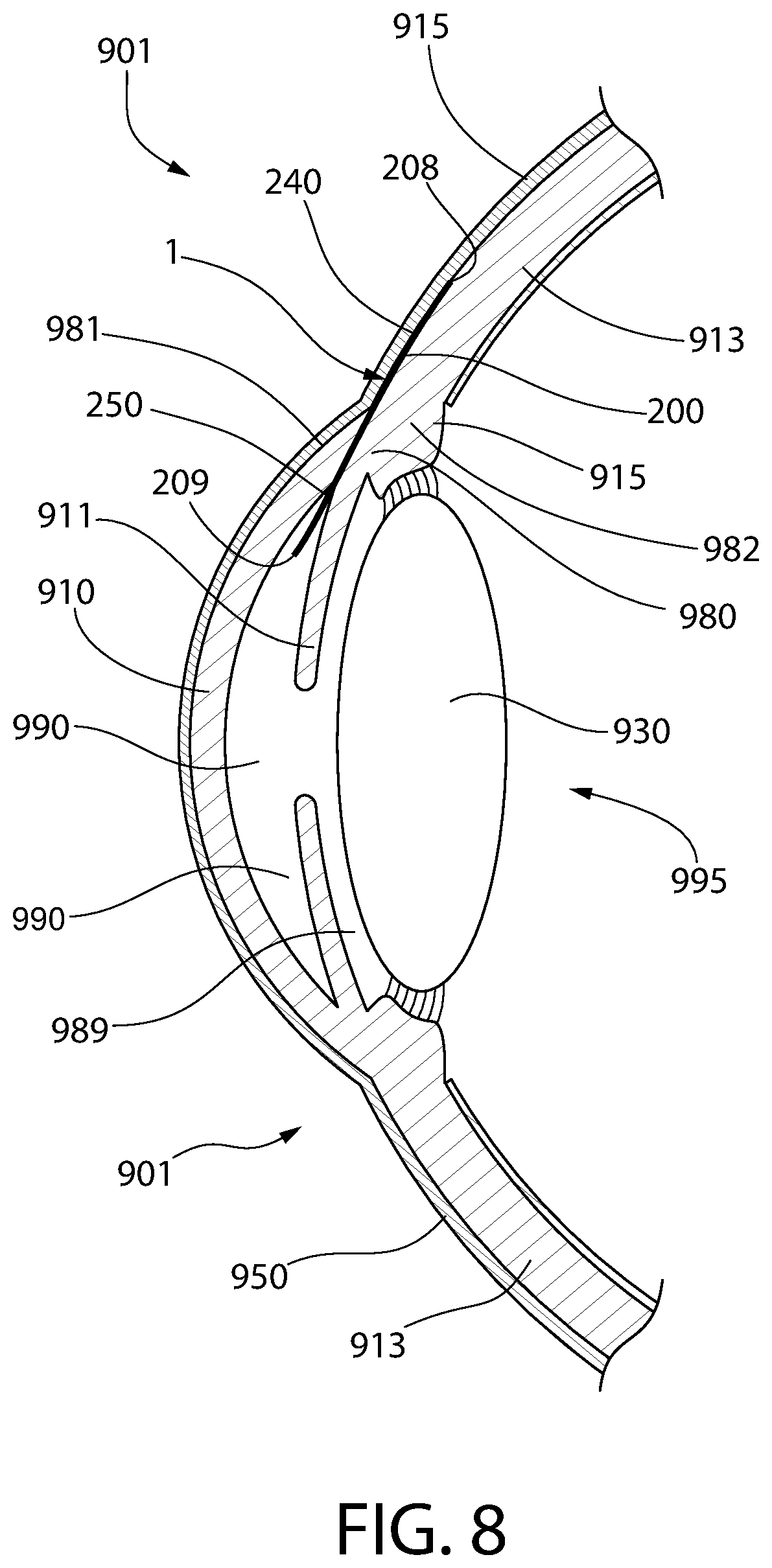 Patent US12303429 Figure 8 – Method and device for treating eye disease