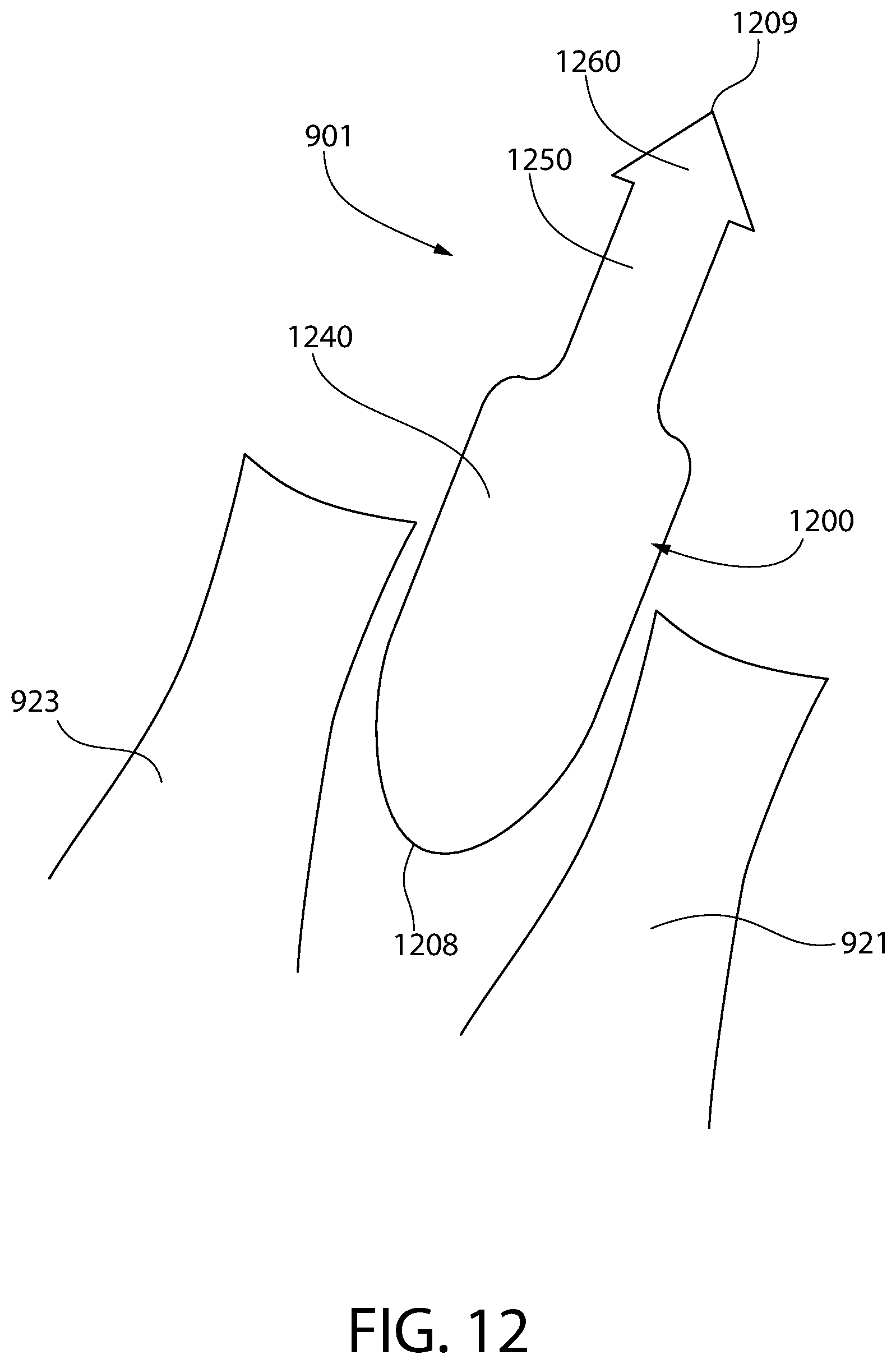 Patent US12303429 Figure 12 – Method and device for treating eye disease
