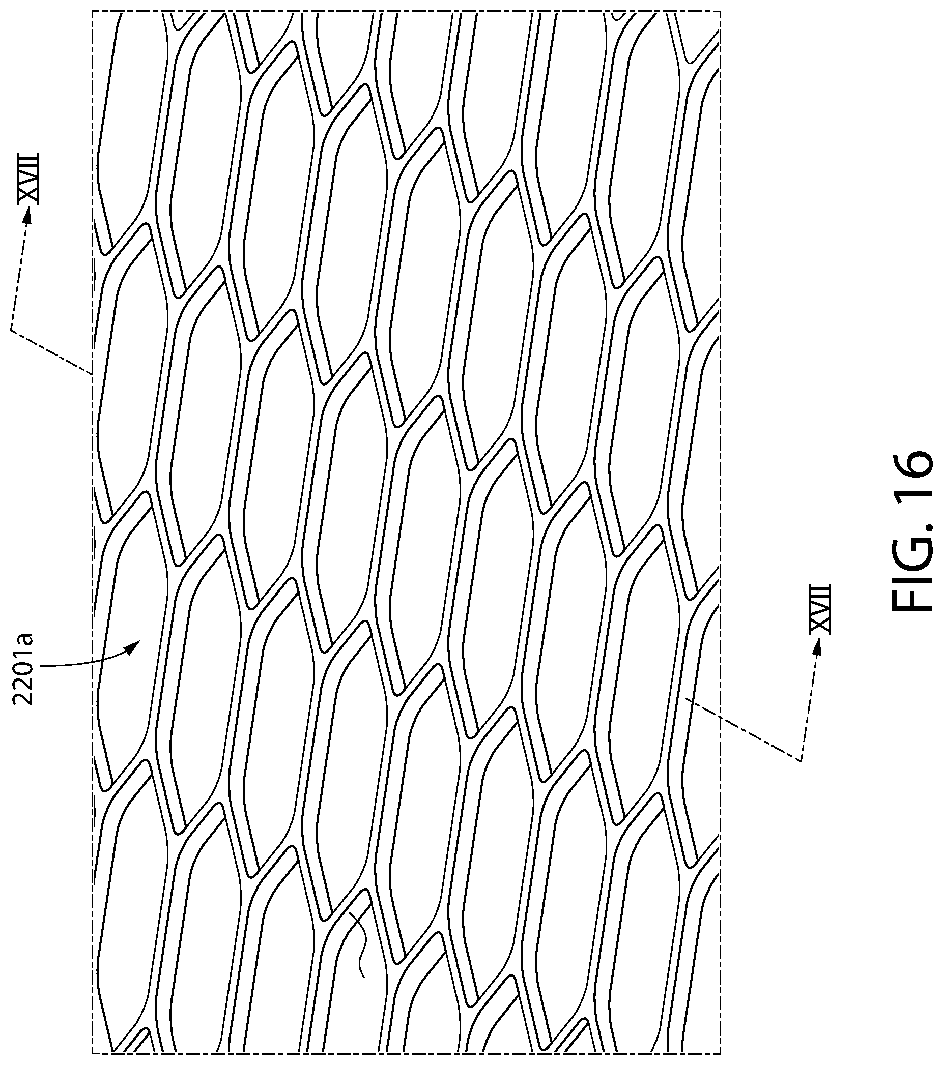 Patent US12303429 Figure 16 – Method and device for treating eye disease