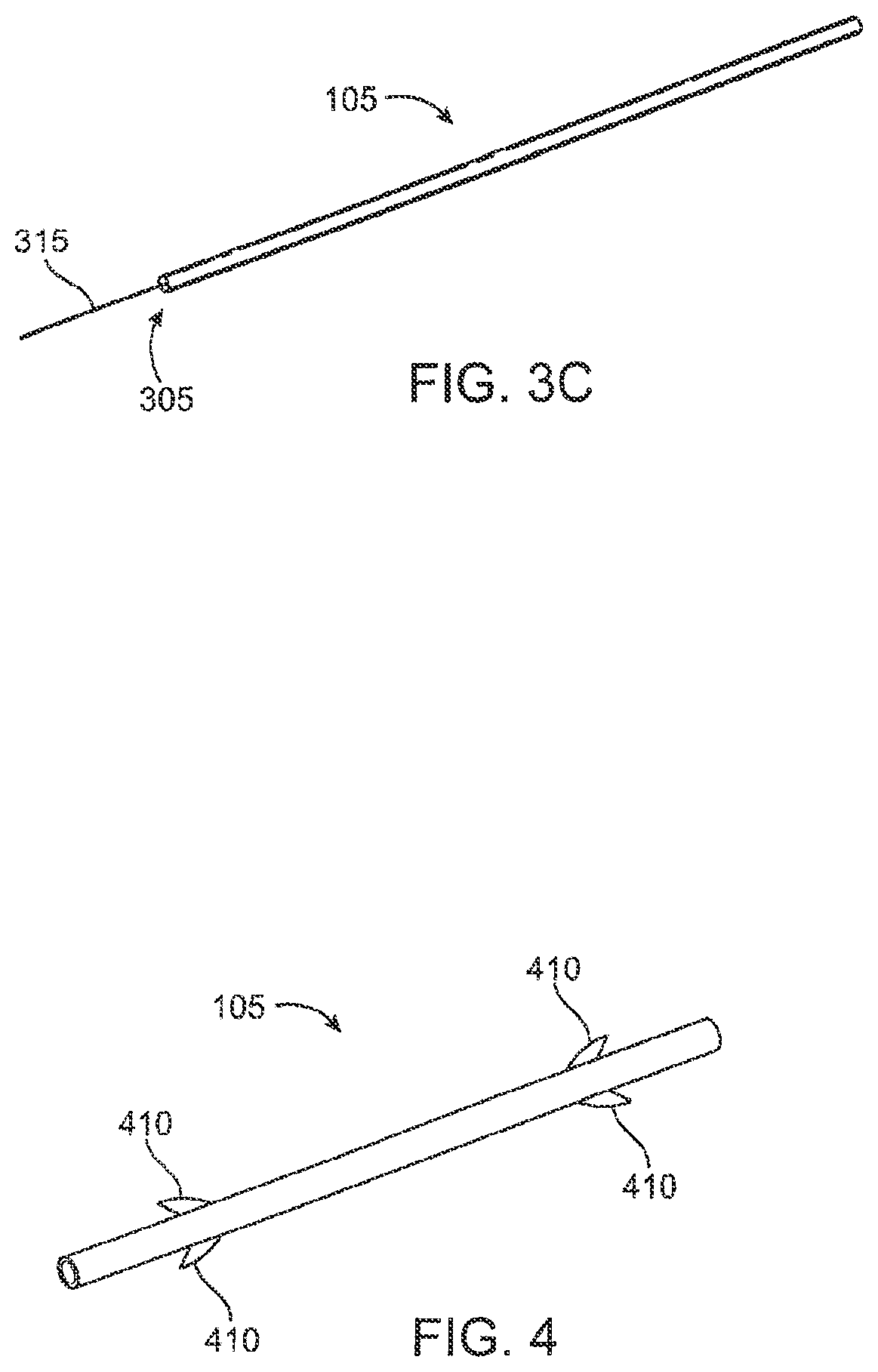 Patent US12303430 Figure 4 – Glaucoma treatment device
