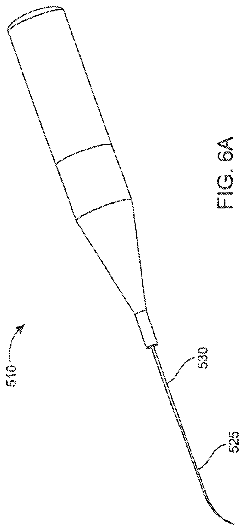Patent US12303430 Figure 6 – Glaucoma treatment device