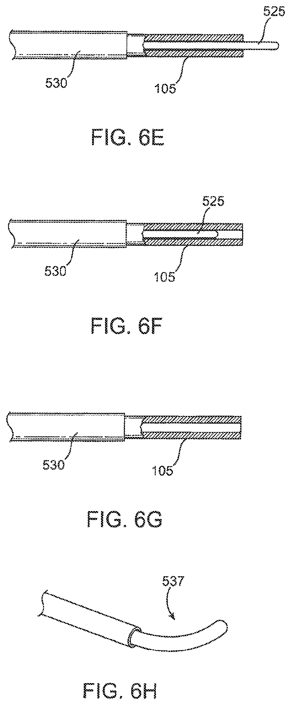 Patent US12303430 Figure 9 – Glaucoma treatment device