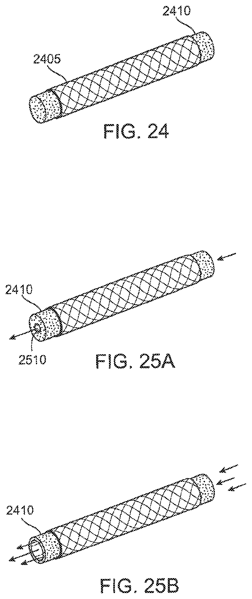 Patent US12303430 Figure 20 – Glaucoma treatment device