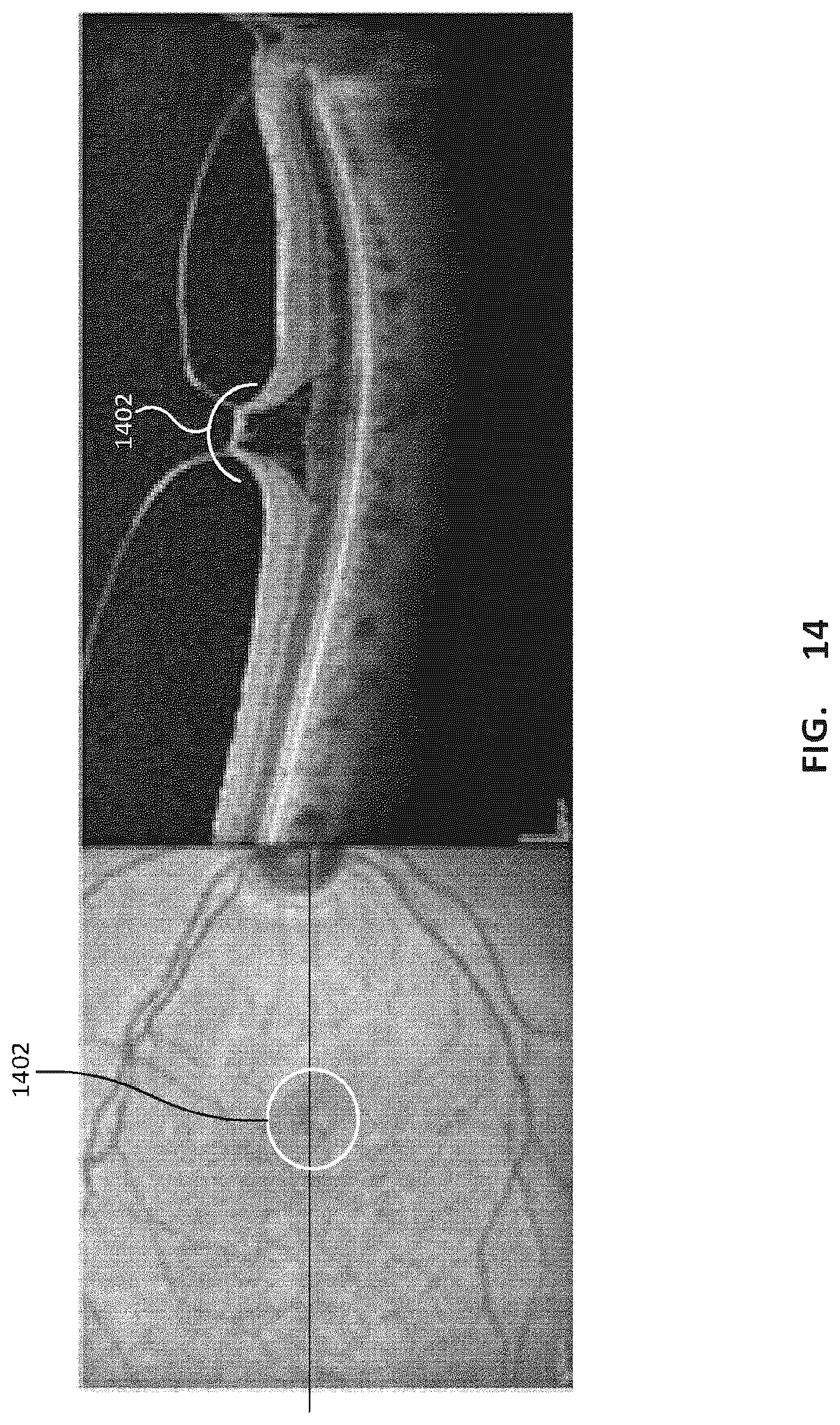Patent US12303432 Figure 14 – Ophthalmological imaging and laser delivery device, system and methods
