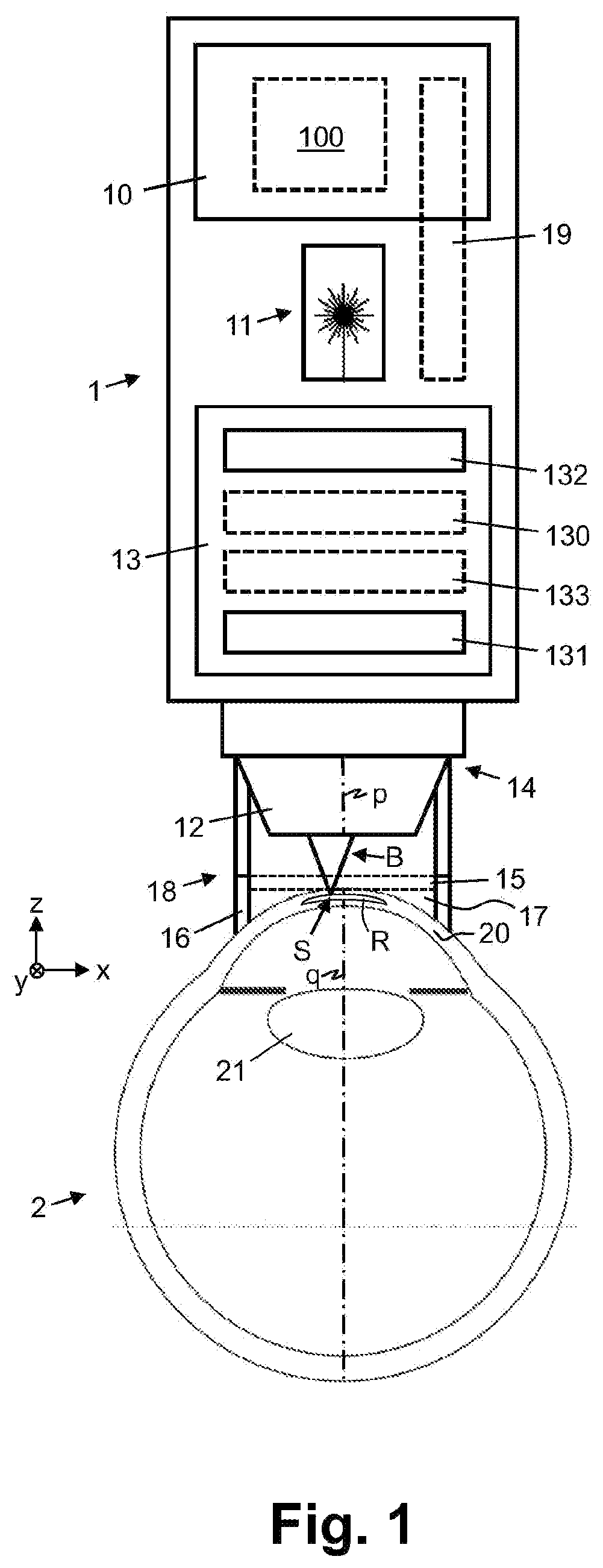 Patent US12303433 Figure 1 – Ophthalmological device for refractive correction of a cornea