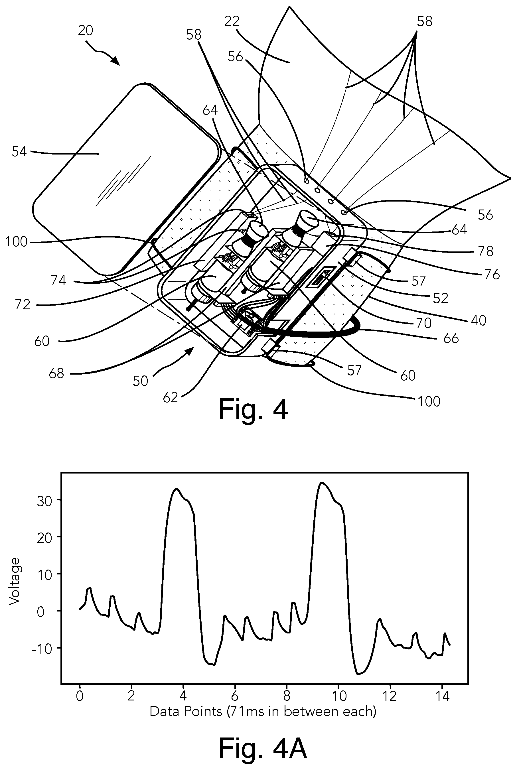 Patent US12303447 Figure 3 – Telekinetic bionic glove assembly