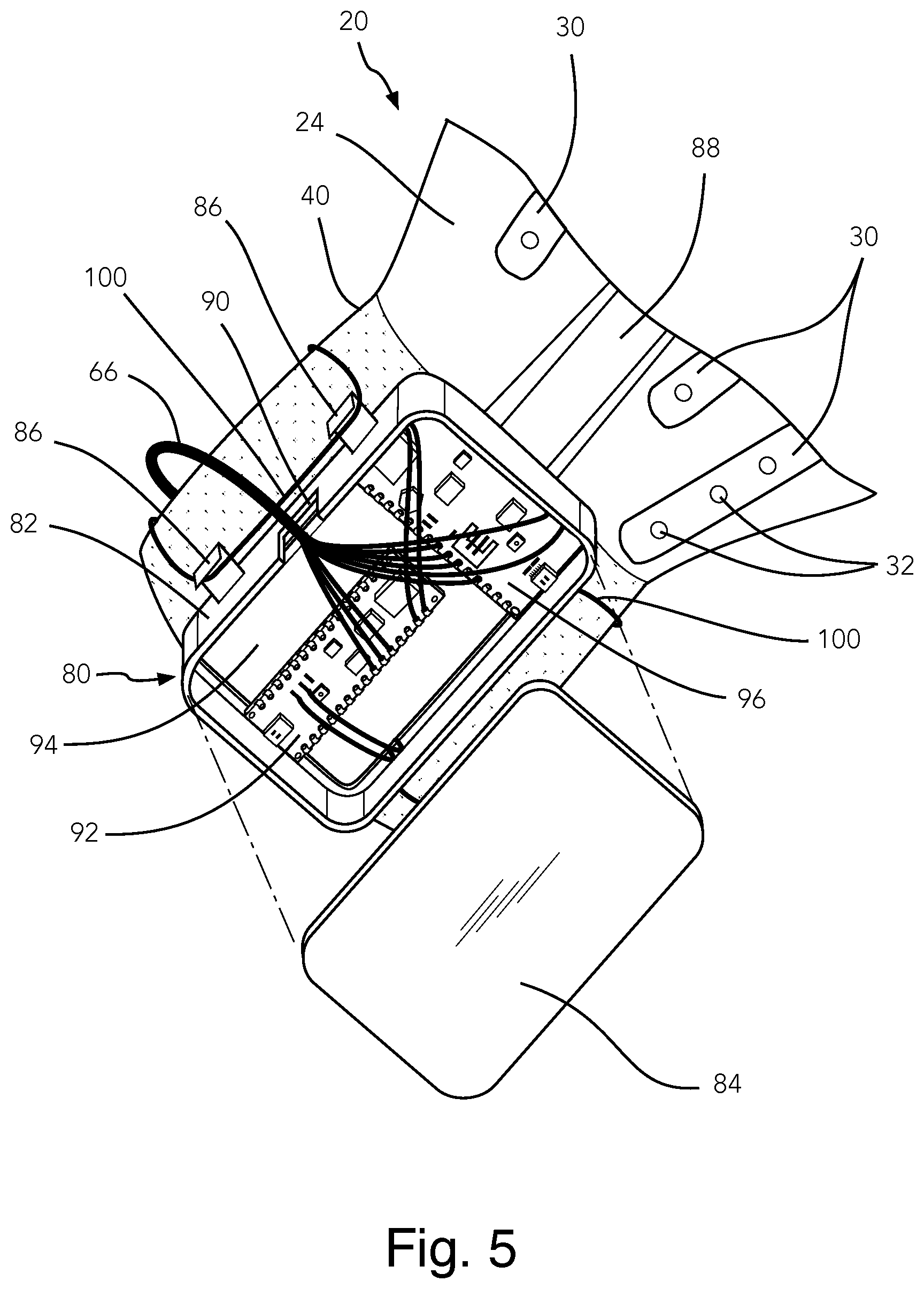 Patent US12303447 Figure 4 – Telekinetic bionic glove assembly