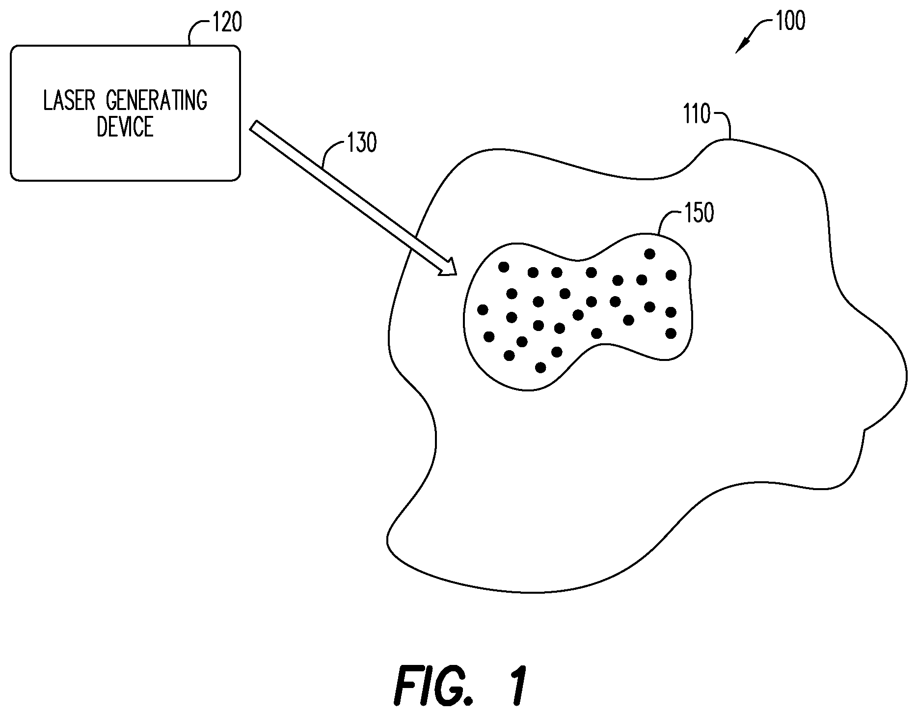 Patent US12303452 Figure 1 – Systems and methods for laser treatment of cellulite