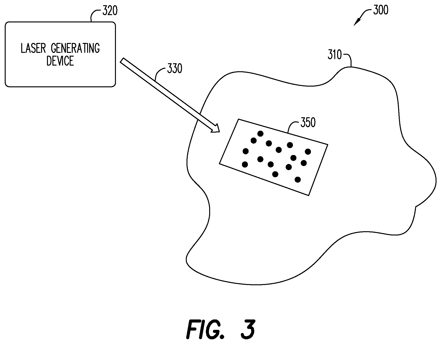 Patent US12303452 Figure 3 – Systems and methods for laser treatment of cellulite