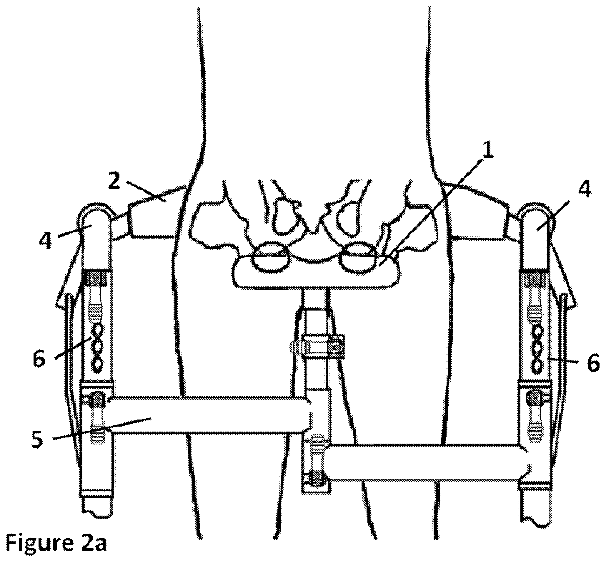 Patent US12303454 Figure 3 – Mobility assistance device with tensioner