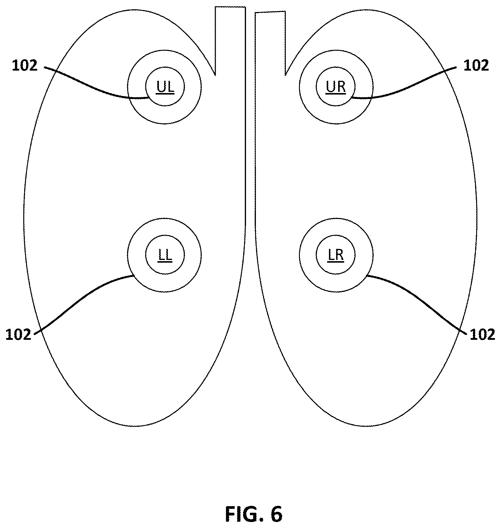 Patent US12303455 Figure 6 – Therapeutic technique using electrical impedance spectroscopy