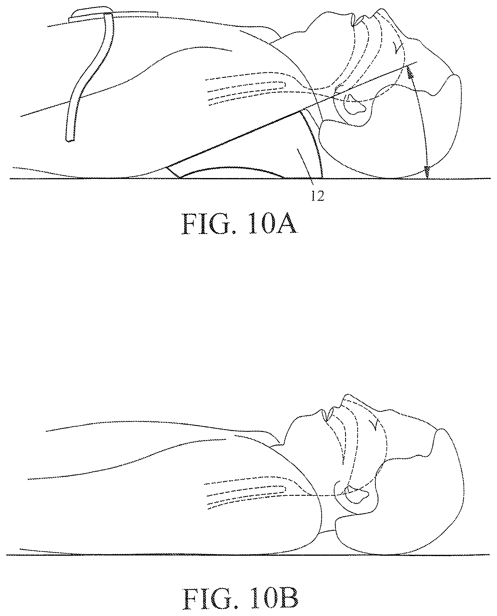 Patent US12303456 Figure 16 – Automated resuscitation device with ventilation sensing and prompting