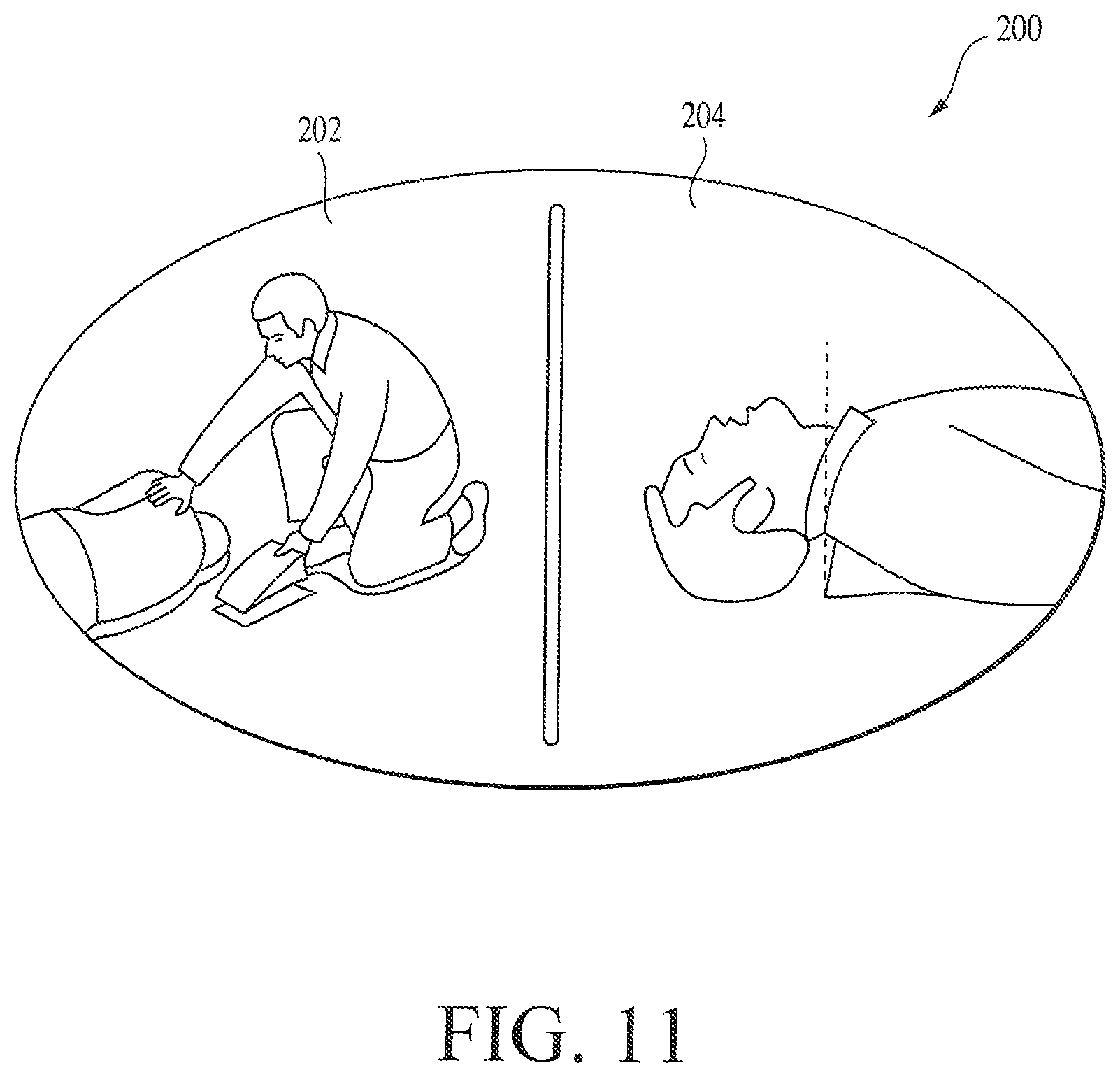 Patent US12303456 Figure 17 – Automated resuscitation device with ventilation sensing and prompting