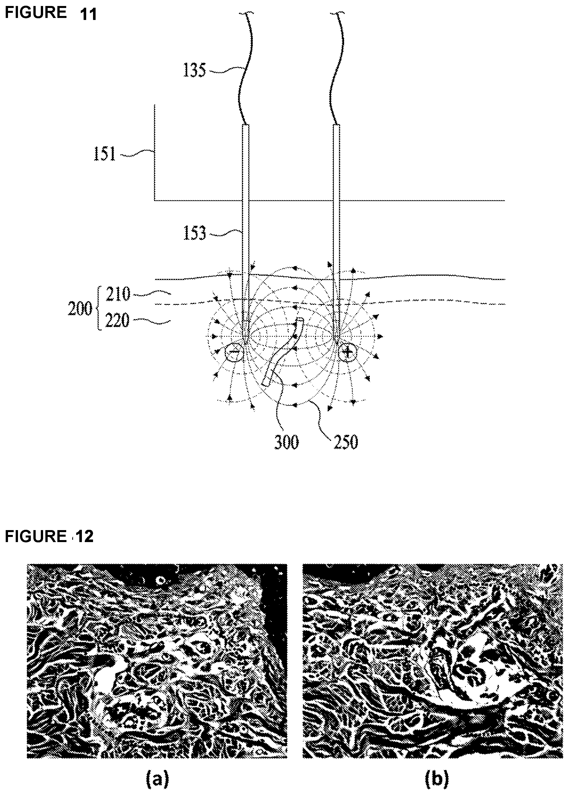Patent US12303459 Figure 15 – Method, system, and apparatus for dermatological treatment