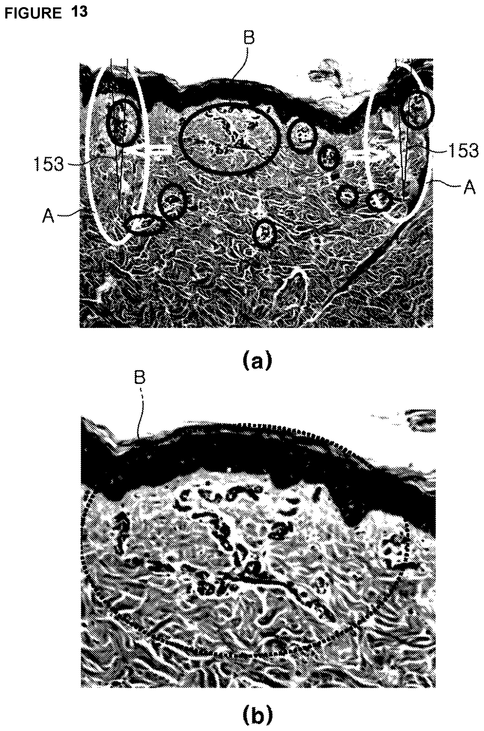 Patent US12303459 Figure 16 – Method, system, and apparatus for dermatological treatment