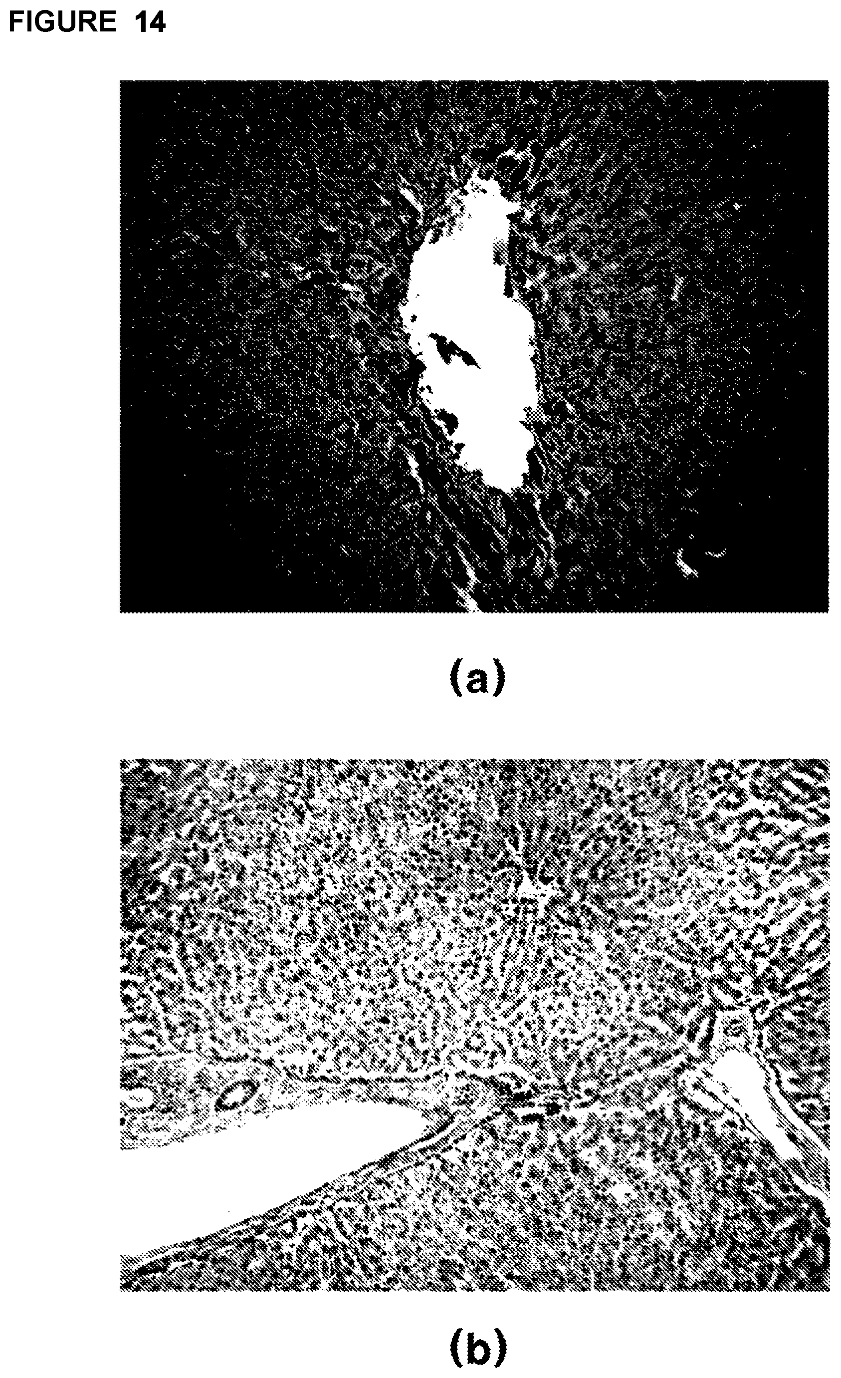 Patent US12303459 Figure 17 – Method, system, and apparatus for dermatological treatment