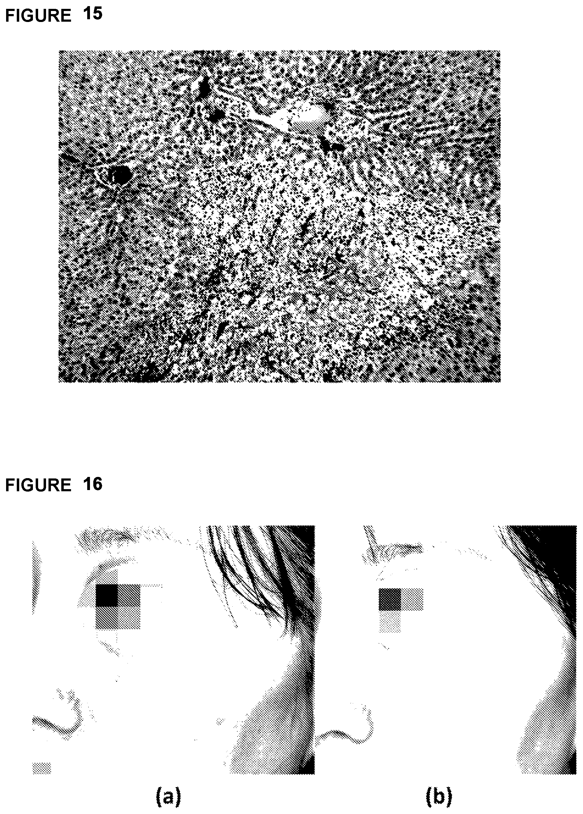 Patent US12303459 Figure 18 – Method, system, and apparatus for dermatological treatment