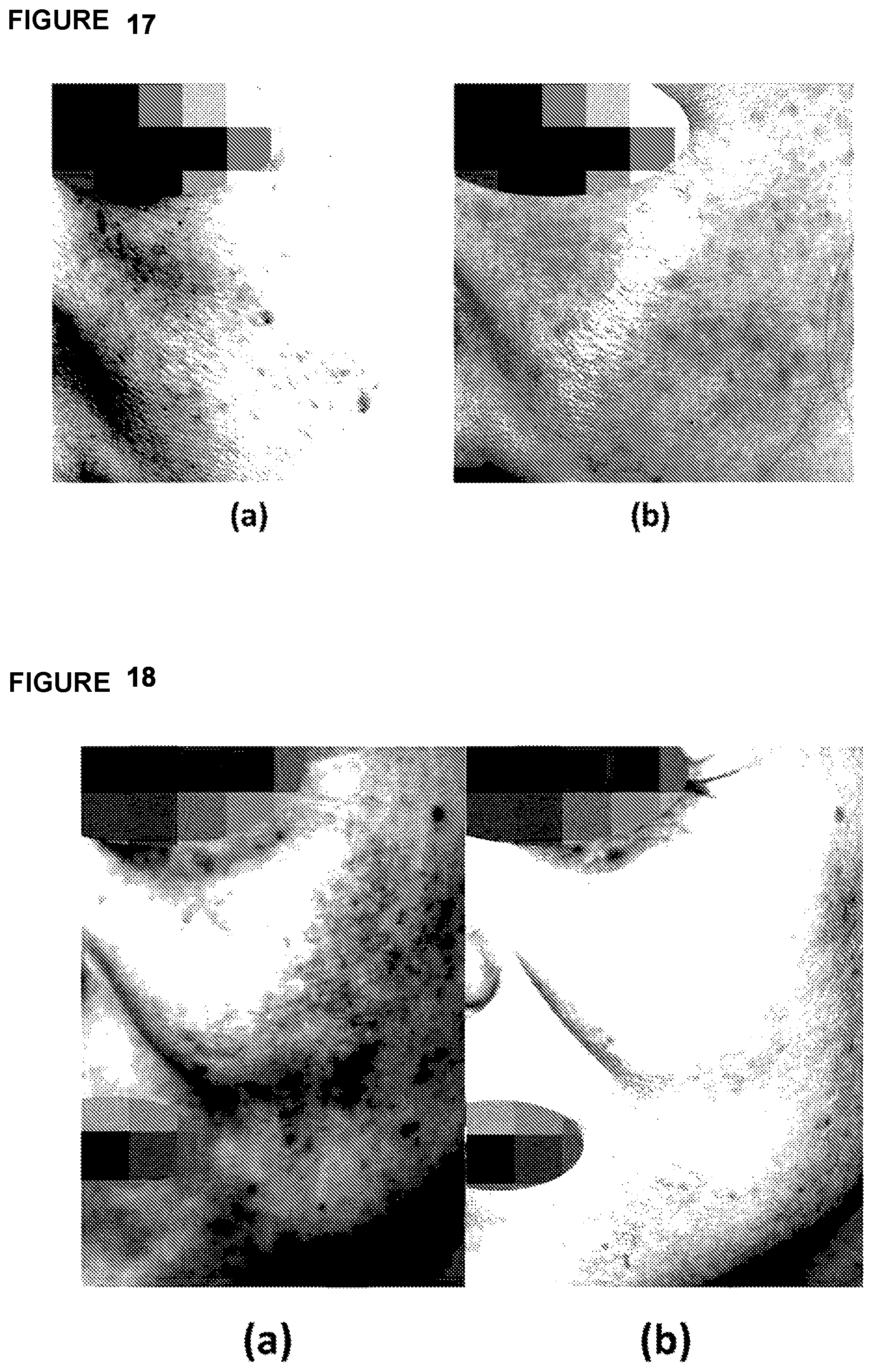 Patent US12303459 Figure 19 – Method, system, and apparatus for dermatological treatment