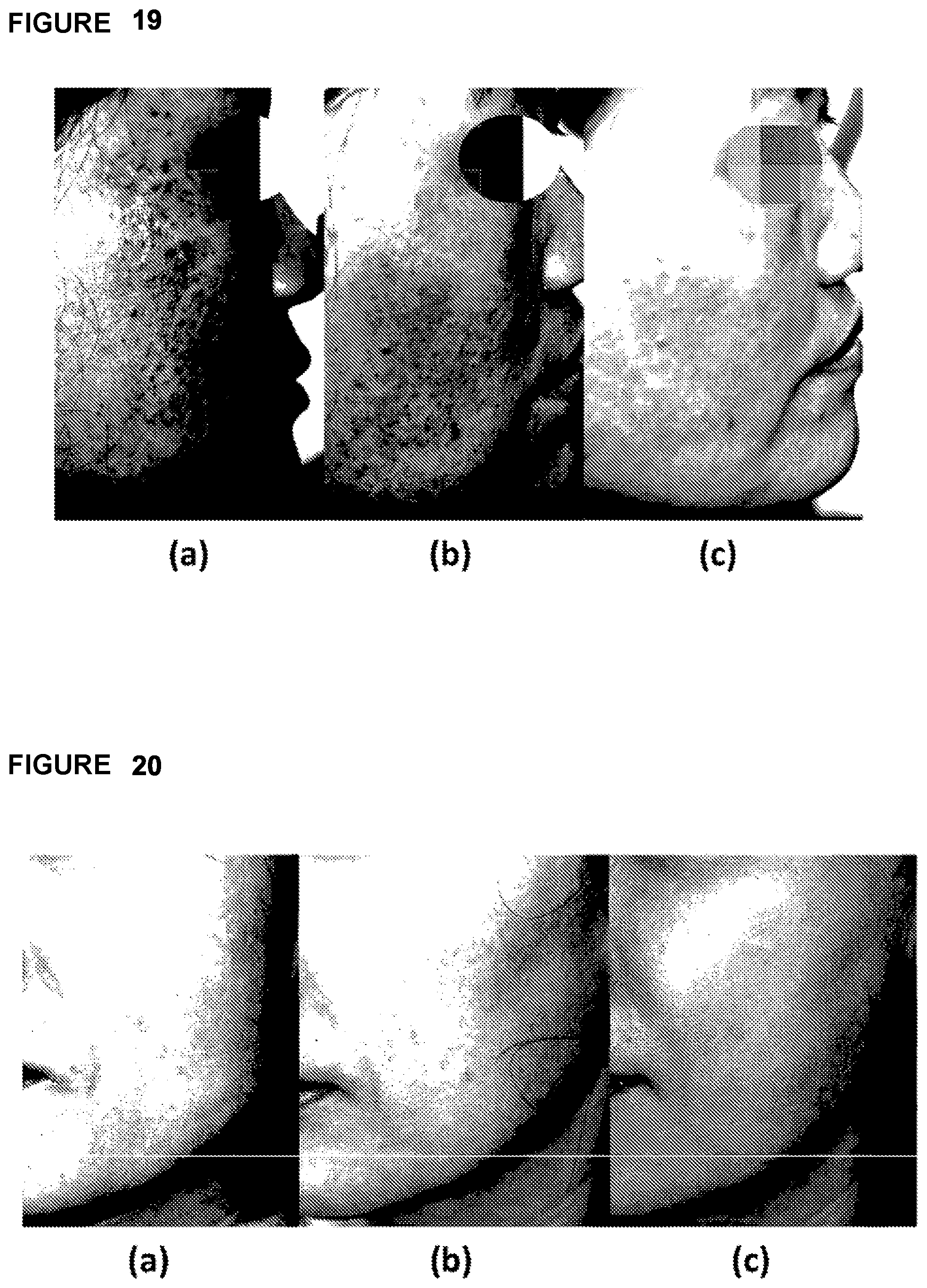Patent US12303459 Figure 20 – Method, system, and apparatus for dermatological treatment