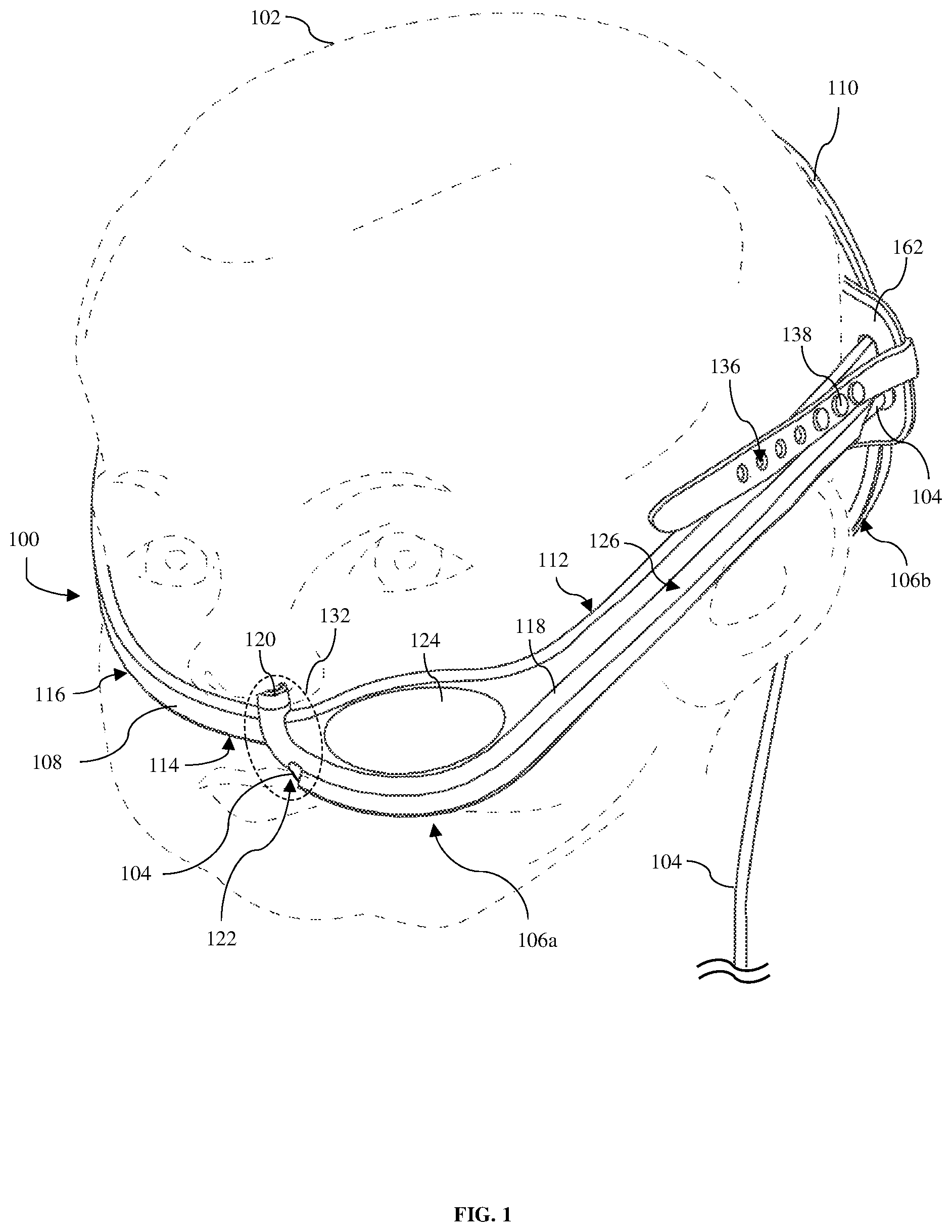 Patent US12303465 Figure 1 – Apparatus, methods, and systems for positioning and retaining a nasally introduced medical tube to a patient