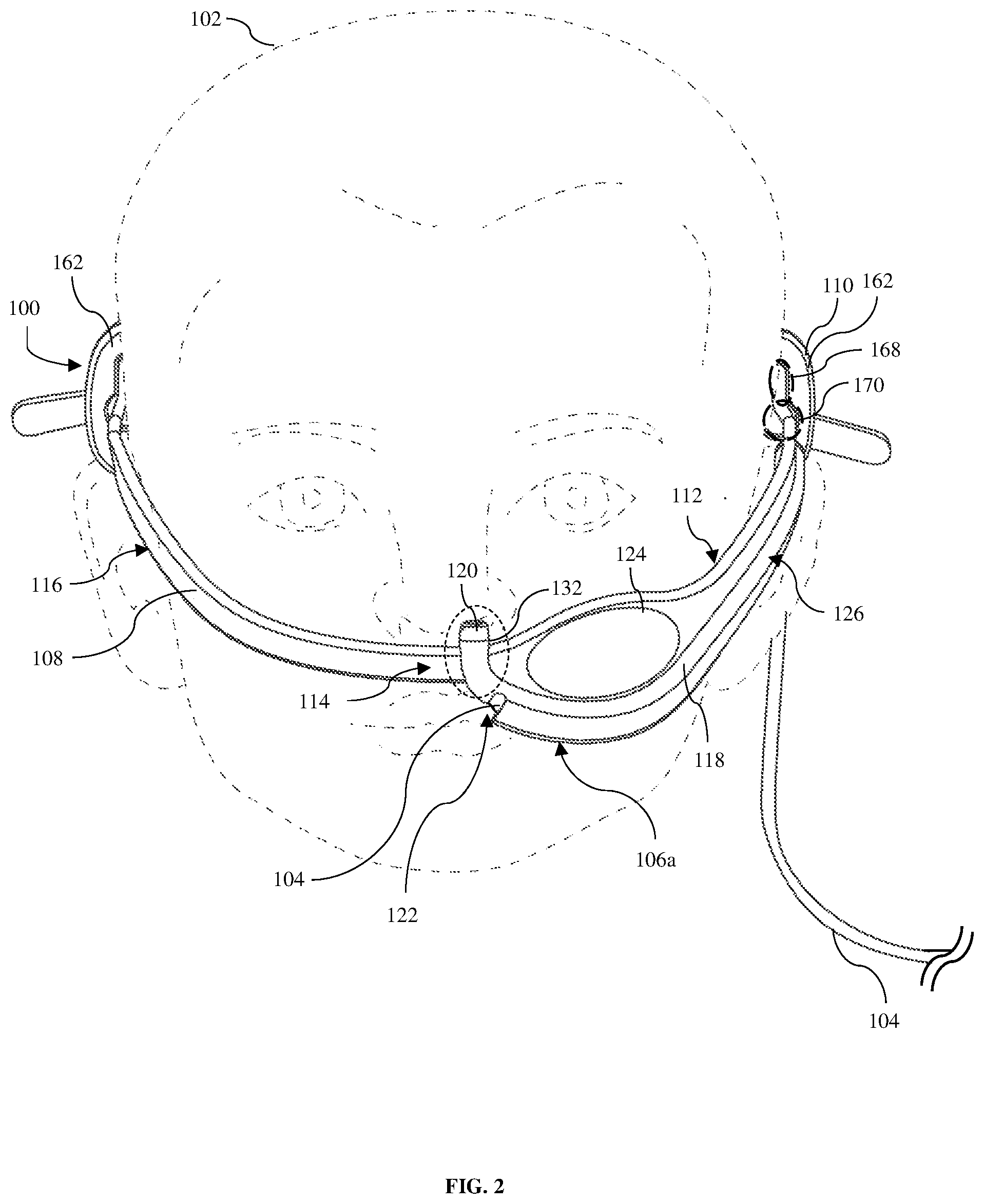 Patent US12303465 Figure 2 – Apparatus, methods, and systems for positioning and retaining a nasally introduced medical tube to a patient