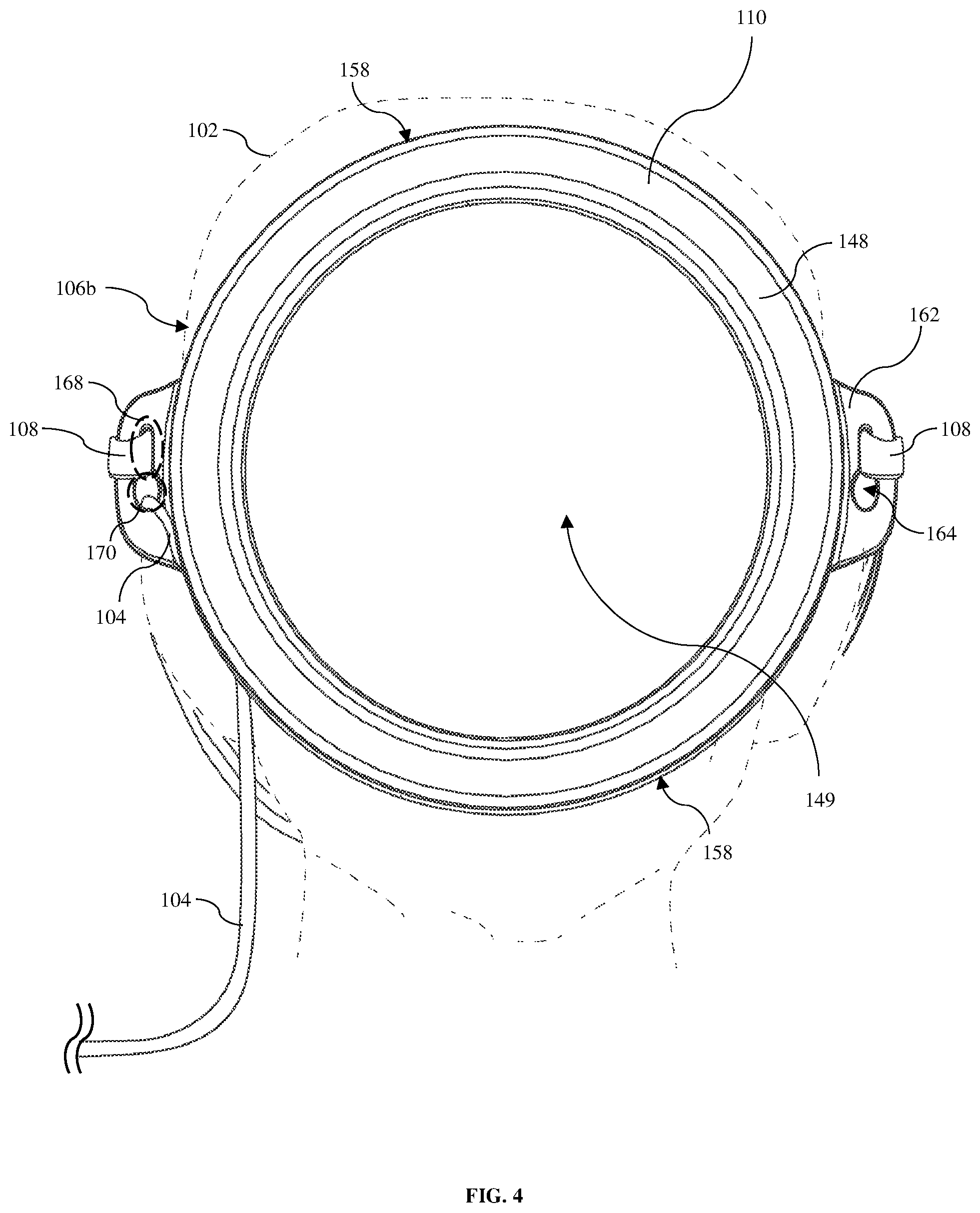 Patent US12303465 Figure 4 – Apparatus, methods, and systems for positioning and retaining a nasally introduced medical tube to a patient