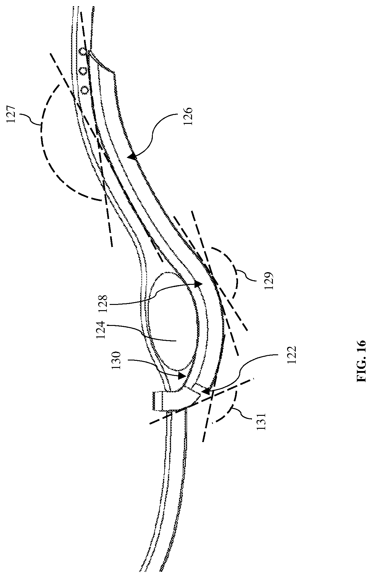 Patent US12303465 Figure 8 – Apparatus, methods, and systems for positioning and retaining a nasally introduced medical tube to a patient