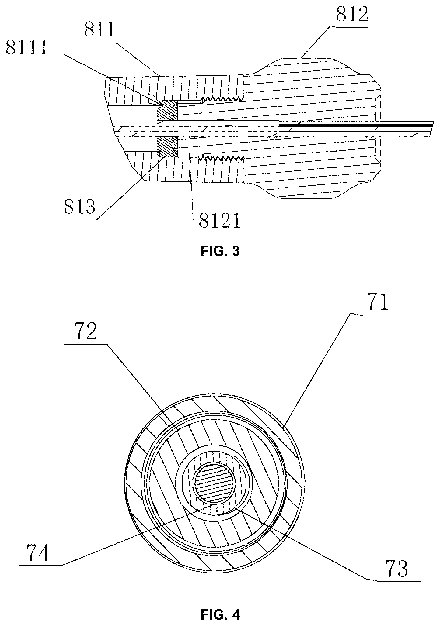Patent US12303466 Figure 2 – Duodenum built-in jejunum cannula releasing system and a use method therefor