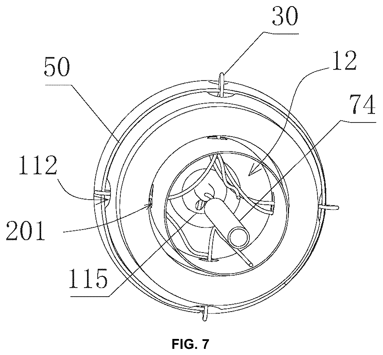 Patent US12303466 Figure 4 – Duodenum built-in jejunum cannula releasing system and a use method therefor