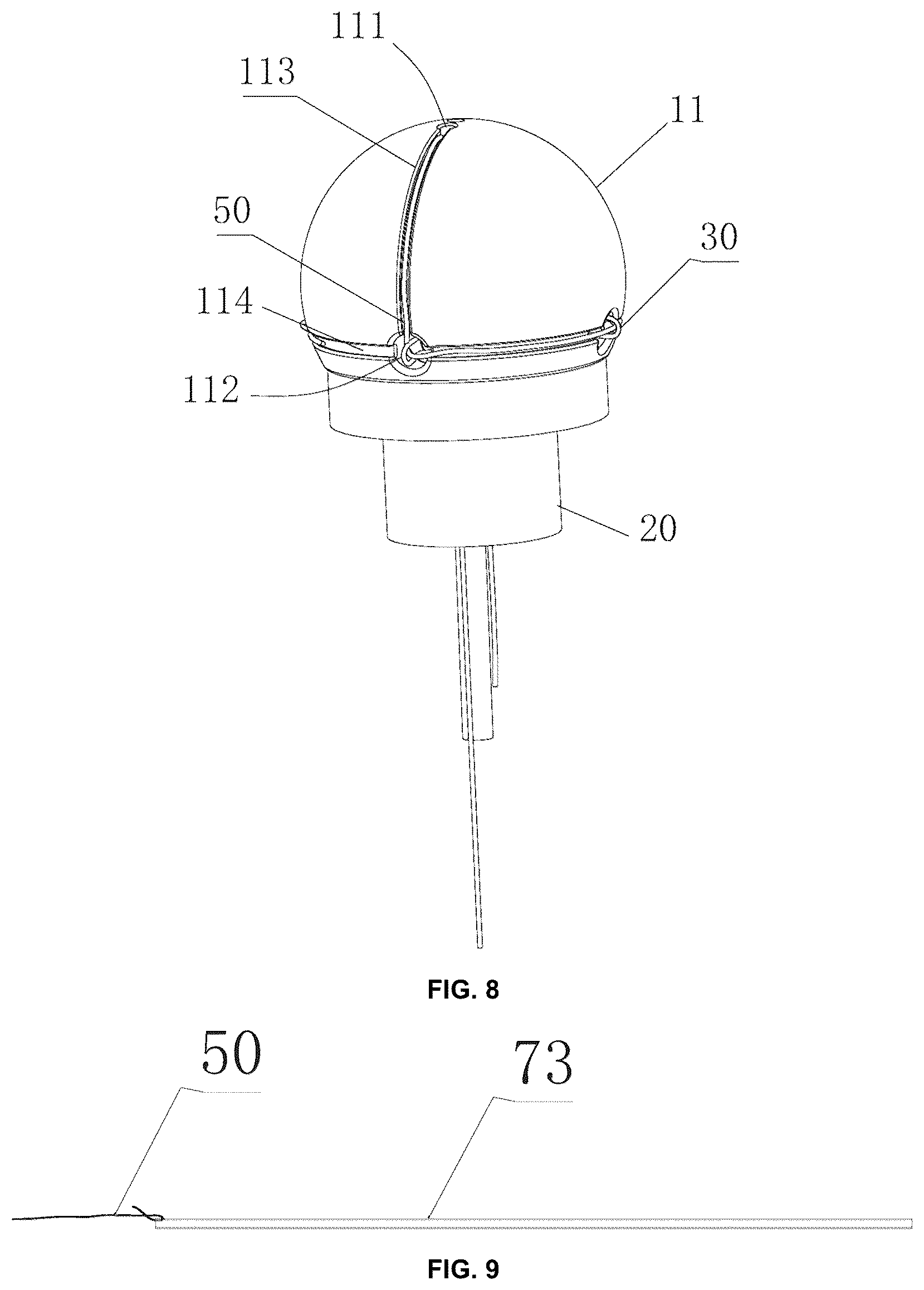 Patent US12303466 Figure 5 – Duodenum built-in jejunum cannula releasing system and a use method therefor