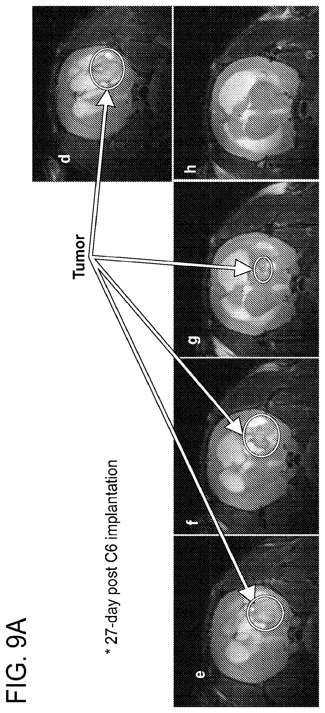 Patent US12303471 Figure 9 – Methods of treatment of temozolomide-resistant glioma using coenzyme Q10