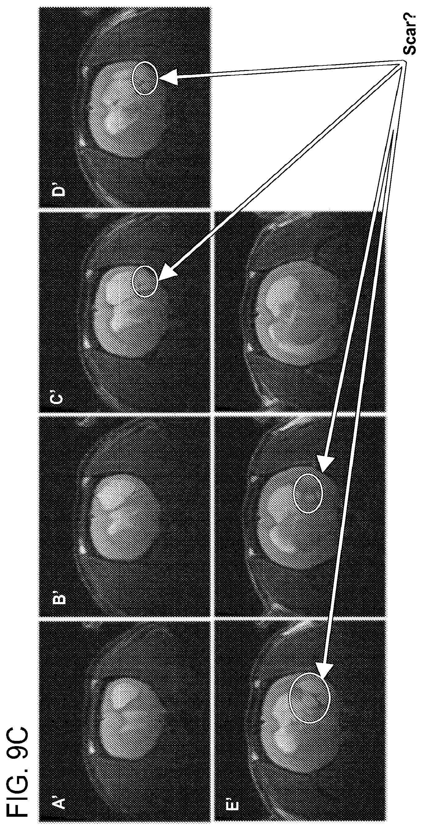Patent US12303471 Figure 11 – Methods of treatment of temozolomide-resistant glioma using coenzyme Q10