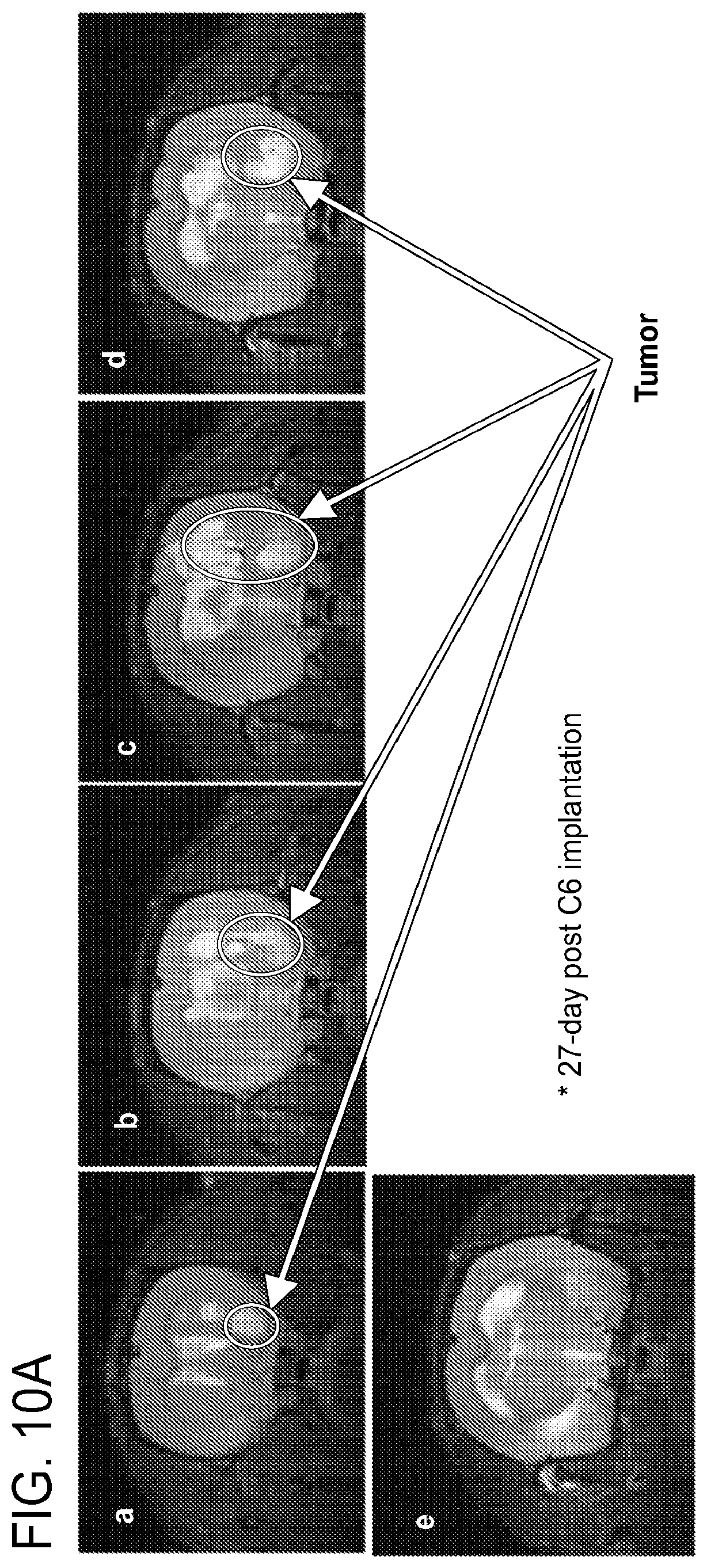 Patent US12303471 Figure 12 – Methods of treatment of temozolomide-resistant glioma using coenzyme Q10