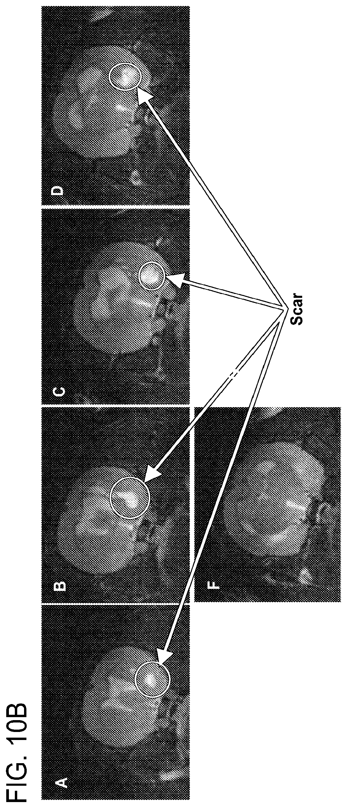 Patent US12303471 Figure 13 – Methods of treatment of temozolomide-resistant glioma using coenzyme Q10