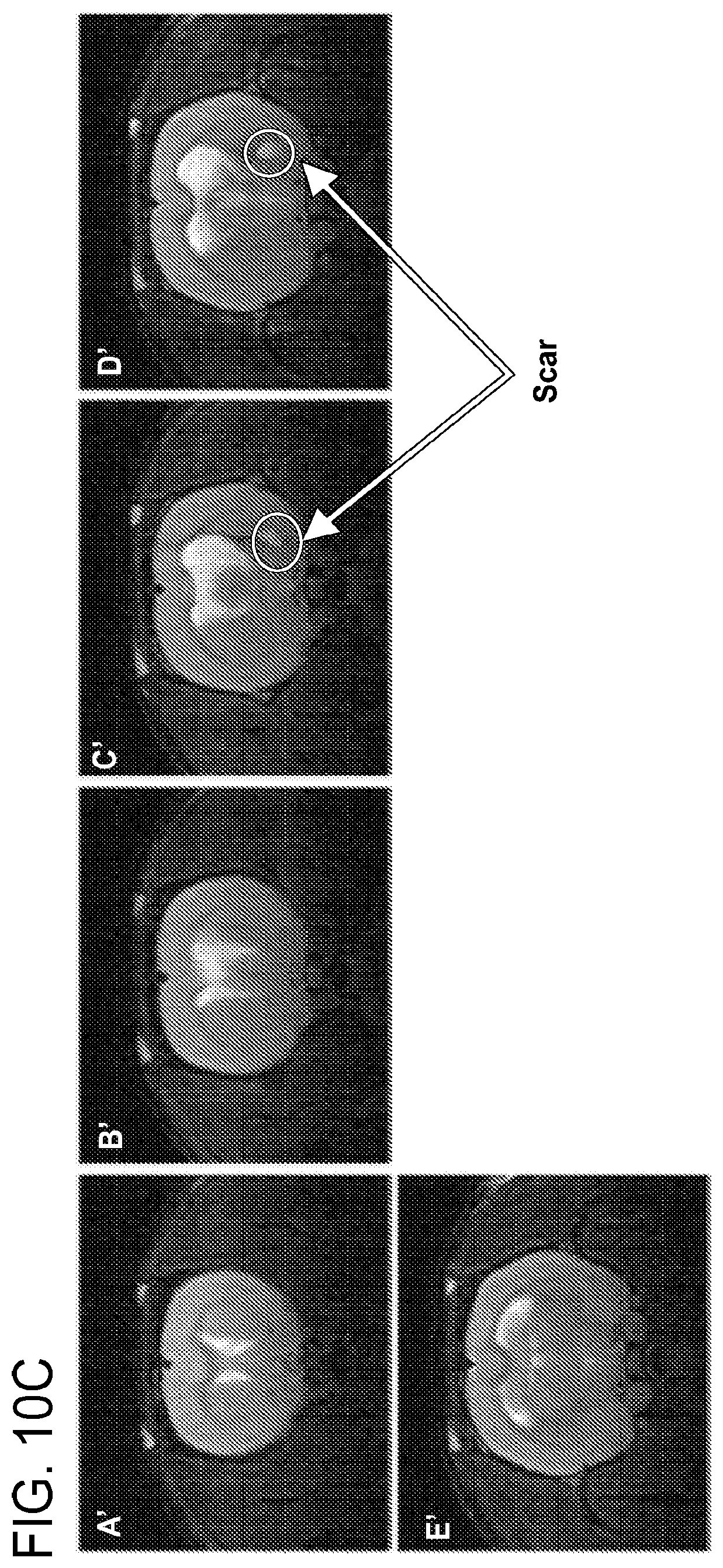 Patent US12303471 Figure 14 – Methods of treatment of temozolomide-resistant glioma using coenzyme Q10