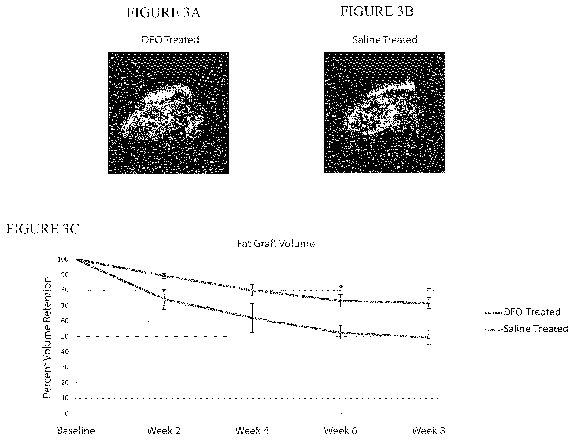 Patent US12303475 Figure 3 – Conditioning irradiated tissue for increasing vascularity