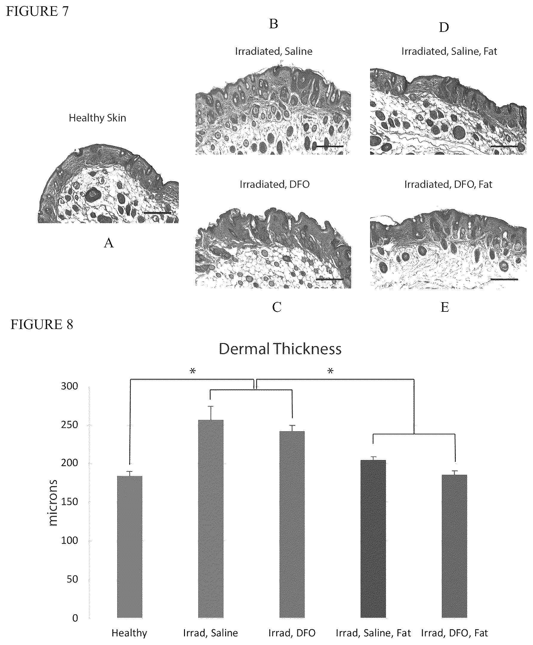 Patent US12303475 Figure 6 – Conditioning irradiated tissue for increasing vascularity