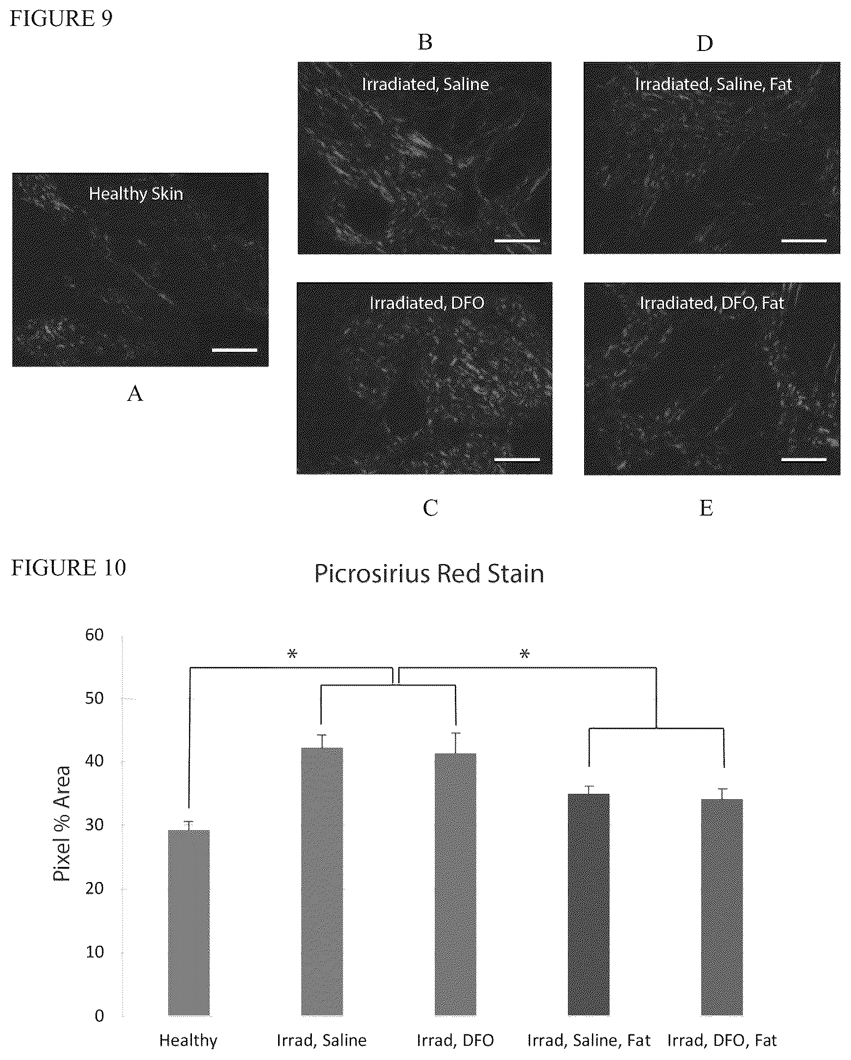 Patent US12303475 Figure 7 – Conditioning irradiated tissue for increasing vascularity